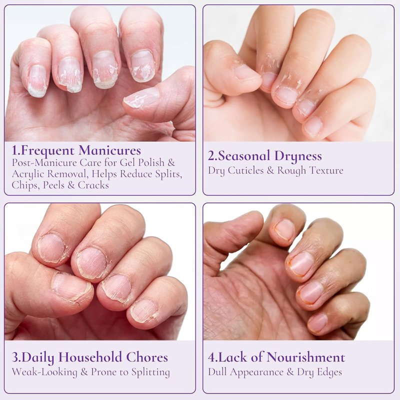 Nail & Cuticle Cream with Keratin, Biotin & Ceramides - Non-Greasy Deep Hydration | 15ml