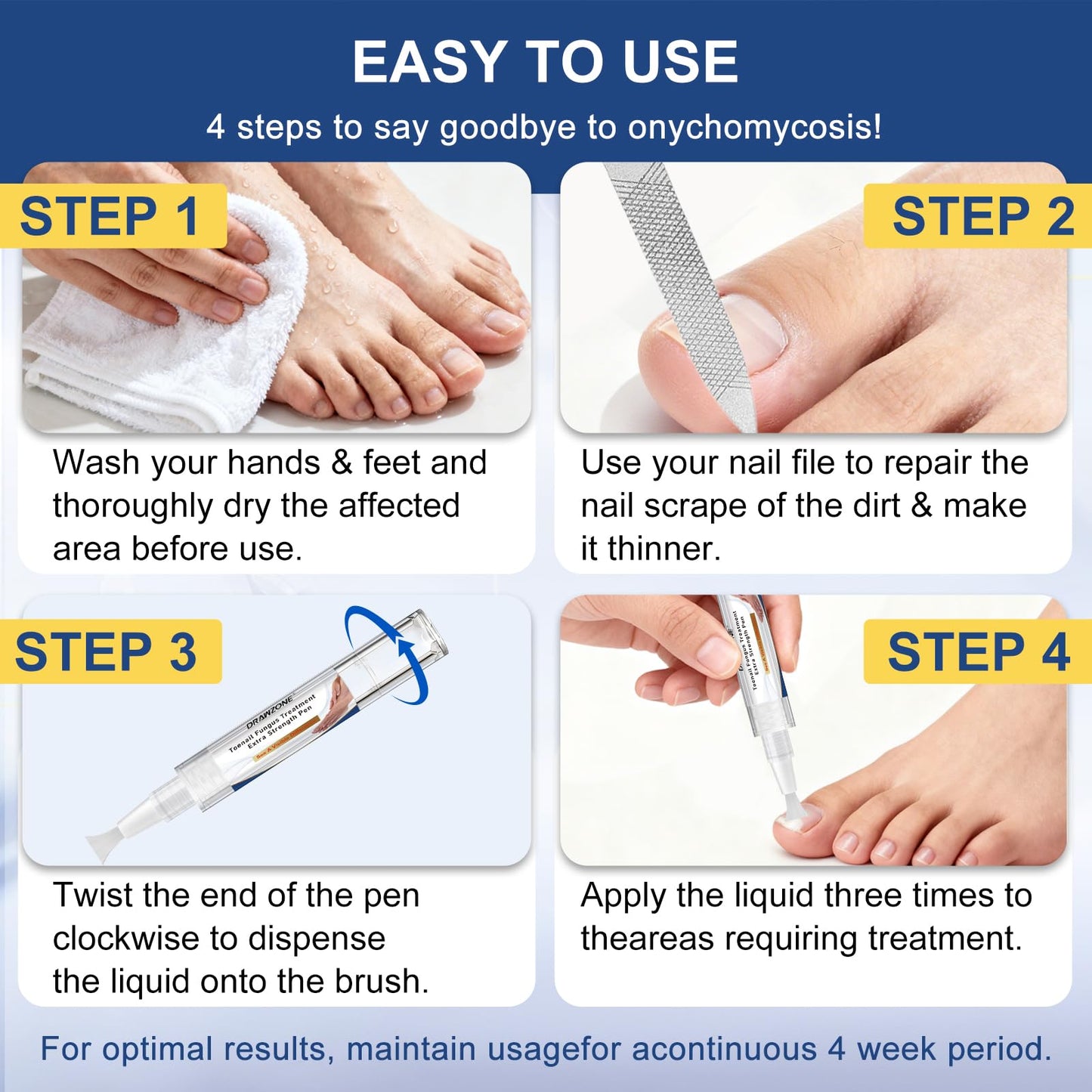 Toenail Fungi Treatment Extra Strength - Fungi Nail Pen, 25% Undecylenic Acid, Ingrown toenail treatment, Fungus nail treatment, yellow toenail, Damaged Nails foot fungus treatment extra strength