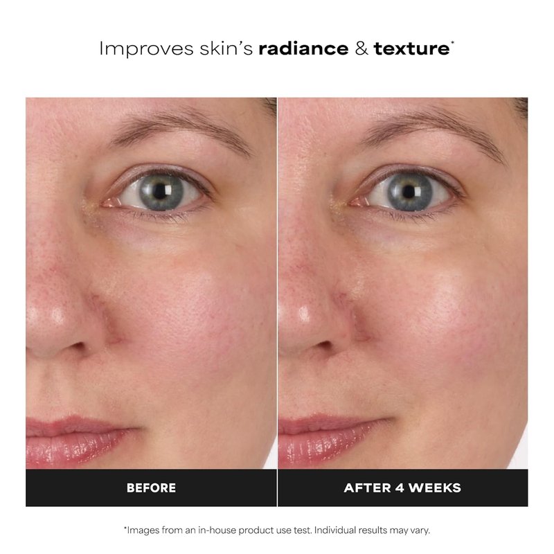 Paula's Choice Skin Balancing Toner - Pore-Reducing Niacinamide Formula for Oily & Combination Skin | Hydrating & Fragrance-Free