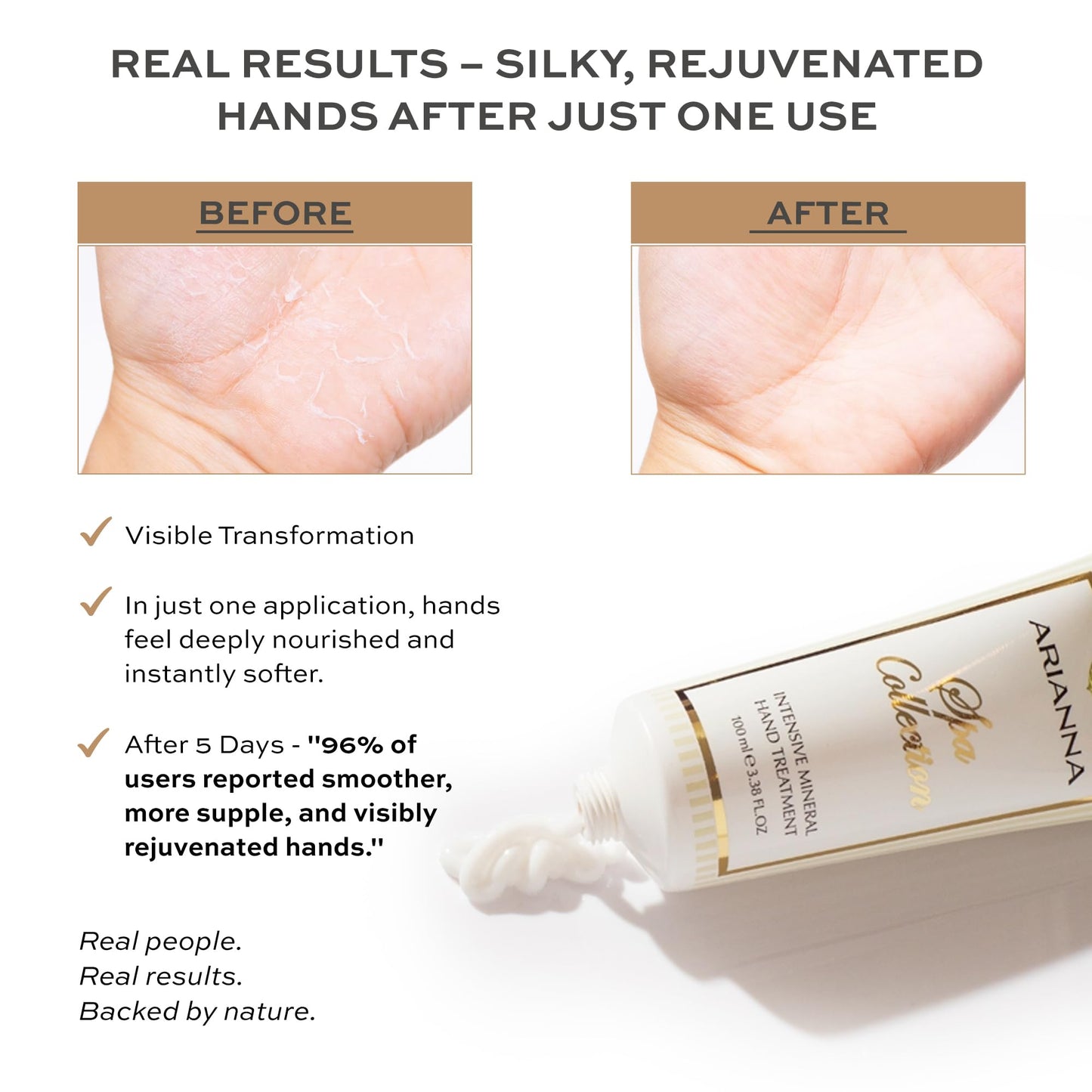 Arianna Skincare Intensive Mineral Hand Treatment Natural Vegan Cream Dead Sea Water Minerals Hand Moisturizer For Smooths Rough Irritated and Dry Skin