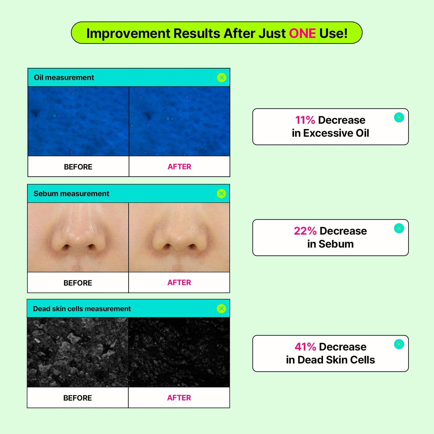 EDIT.B Calming Tok Cica Heartleaf Trouble Pads, Cooling & Hydrating Facial Toner Pads for Sensitive Skin, Mild Exfoliating & Soothing, Easy-Split for Multi-Use, Daily Korean Skin Care (70 Sheets)