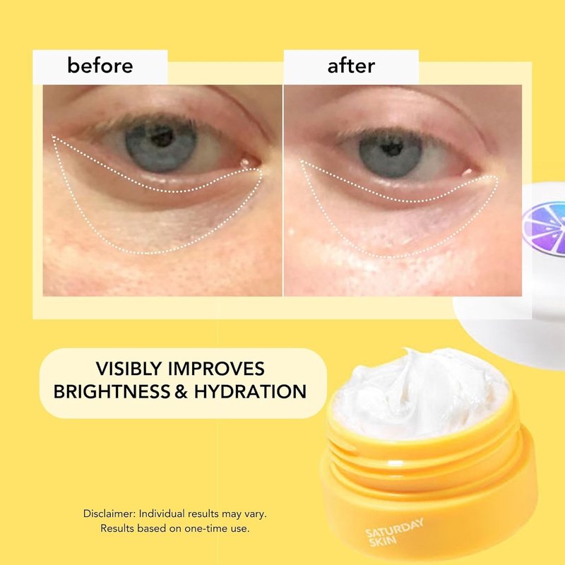 Yuzu Eye Balm - Vitamin C & Niacinamide Under Eye Cream | Hydrating Anti-Aging Treatment for Dark Circles (15ml)