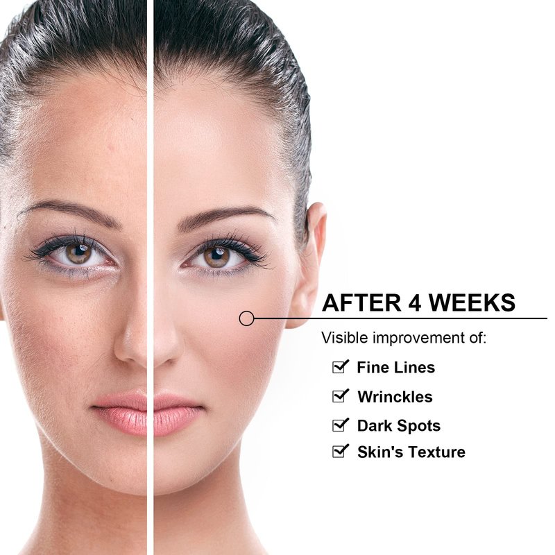 Elitzia Skin Care Carbon Peel Gel Rejuvenation Black Face Doll Facial Skin Deep Cleaning Cream 10.15fl.oz ETBDF30