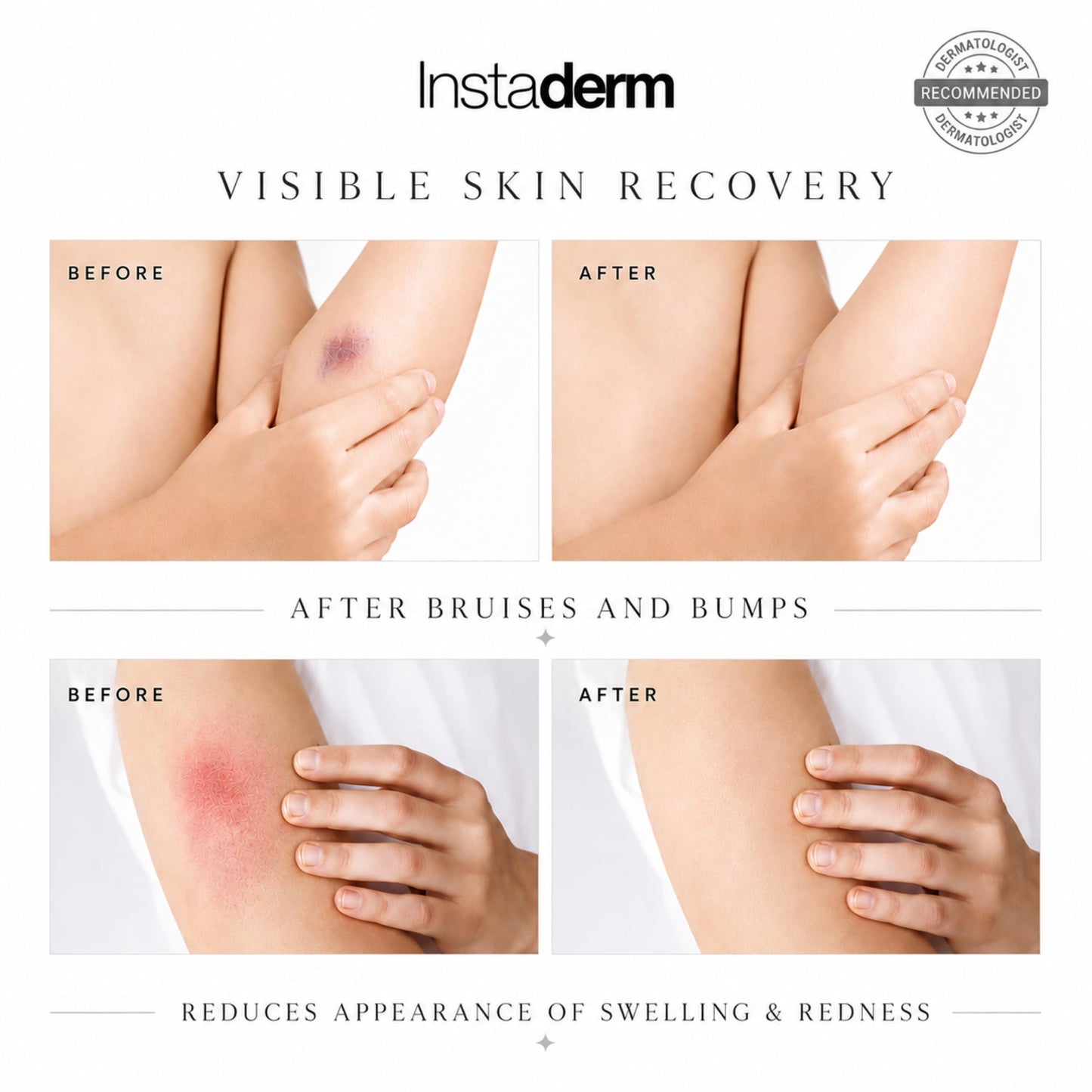 Vitamin K Cream-Revitalizing Formula with Arnica for the Appearance of Brusing, Spider Veins, Broken Capillaries, Uneven Tone & Dark Spot – Under Eye Cream for the Look of Dark Circles & Puffiness