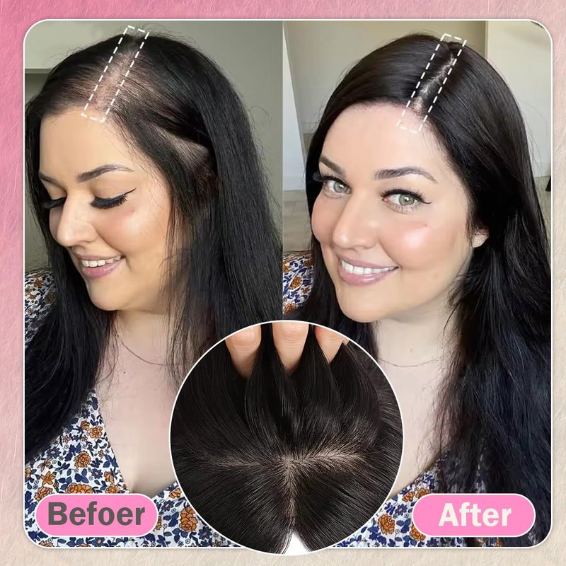 Unipearl Hair Toppers for Women Real Human Hair 12 Inch 360° Cover Remy Human Hair Topper for Women with Thinning Realistic Scalp Clip in Pieces Straight Hair (Natural Black, Side Bangs)