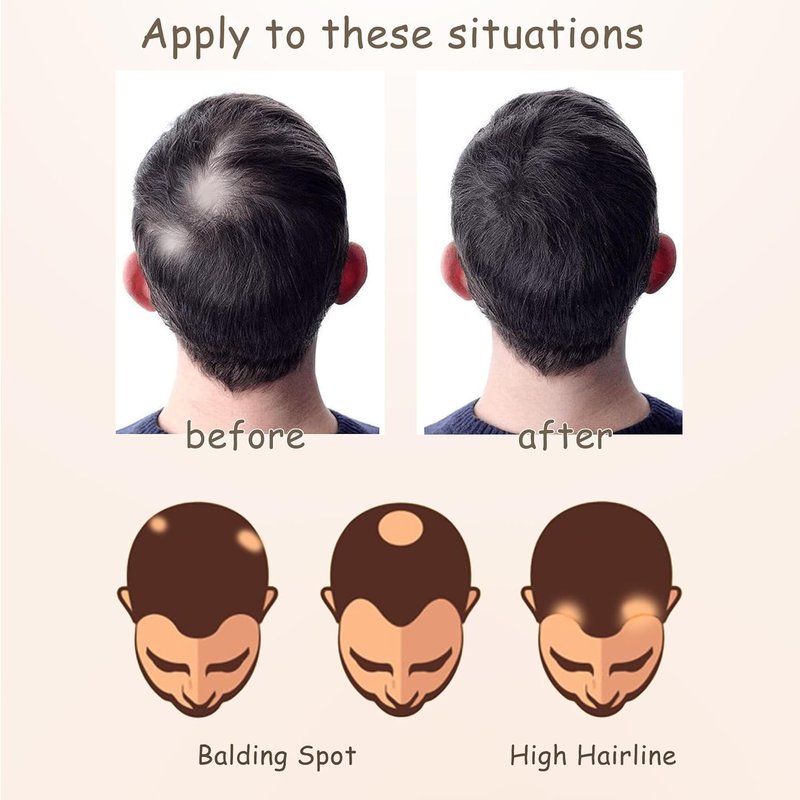 Human Hair Toupee for Hair Loss - Triangle Hair Patch for Men & Women | Dark Brown, 1.6" x 1.6" x 1.6" (2 Pcs)