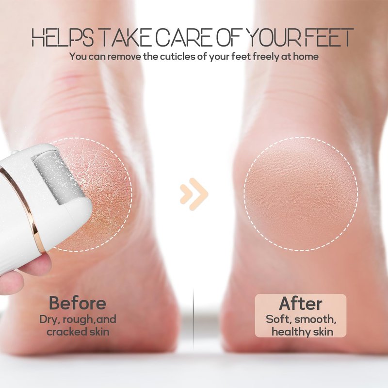 Beefire Electric Foot File and Callus Remover, Rechargeable Pedicure Device with Multiple Heads for Dry Rough Feet Care, Home Use Foot Grinder Tool