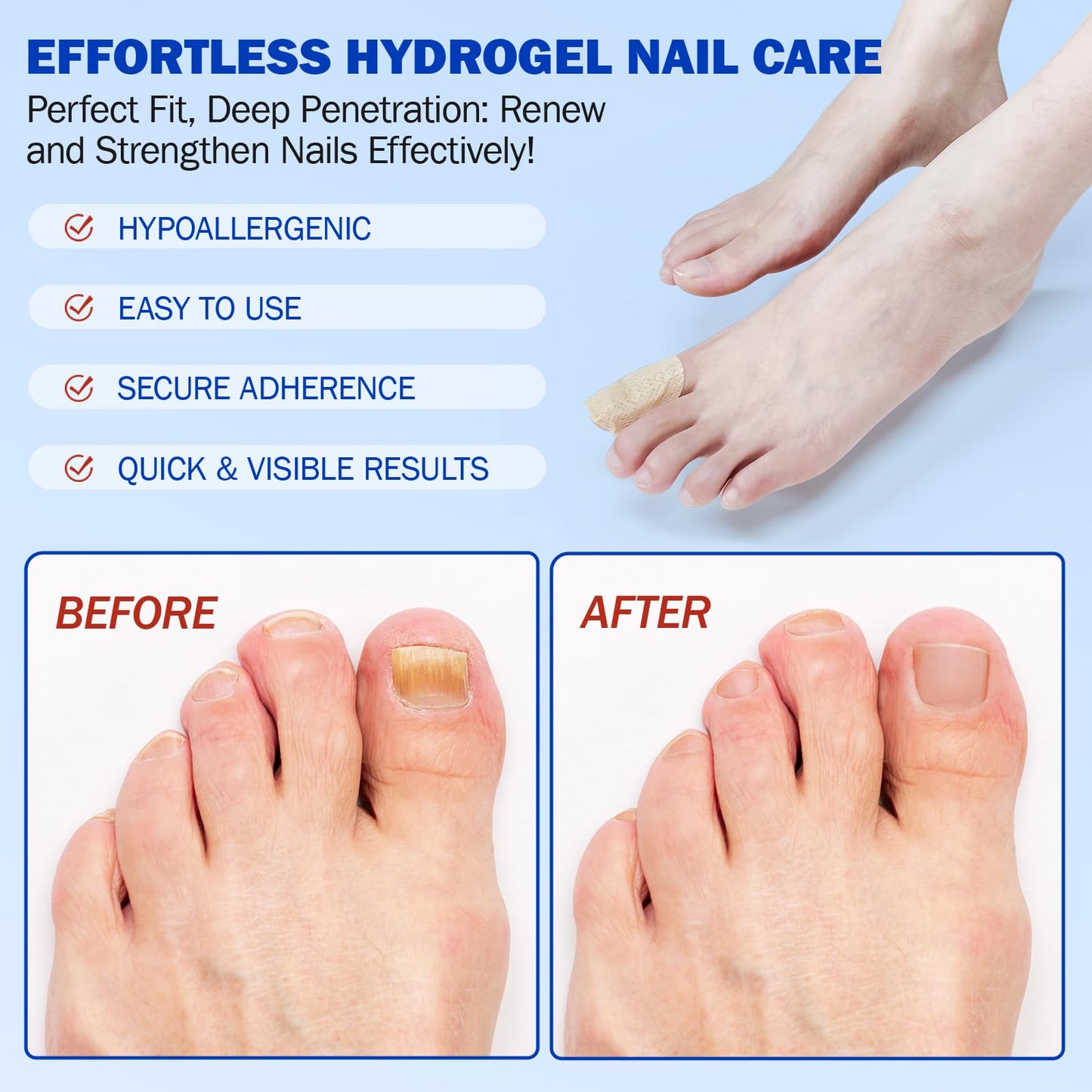 Toenail Treatment Extra Strength, Nail Repair Patches, 8 Hours Overnight Renewal for Thick, Brittle and Discolored Toe Nail, Repair & Strengthen Damaged Foot Nails, 2 Pack (42 Pcs)