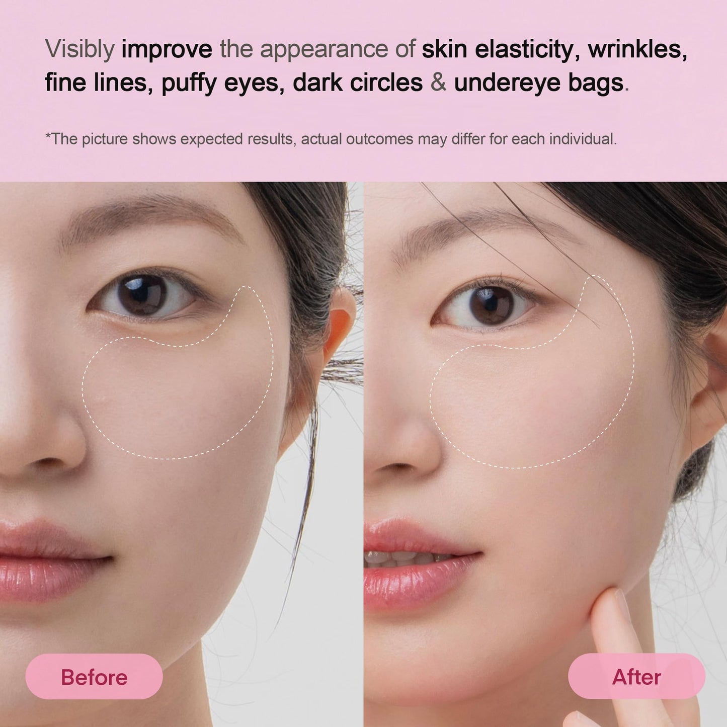 TEREZ & HONOR Peptide Collagen Hydrogel Eye Patches - 24 Pairs Korean Under Eye Masks for Puffy Eyes, Dark Circles, Wrinkles & Undereye Bags - Firming, Hydrating, Travel & Gift Ready Skincare Eye Pads