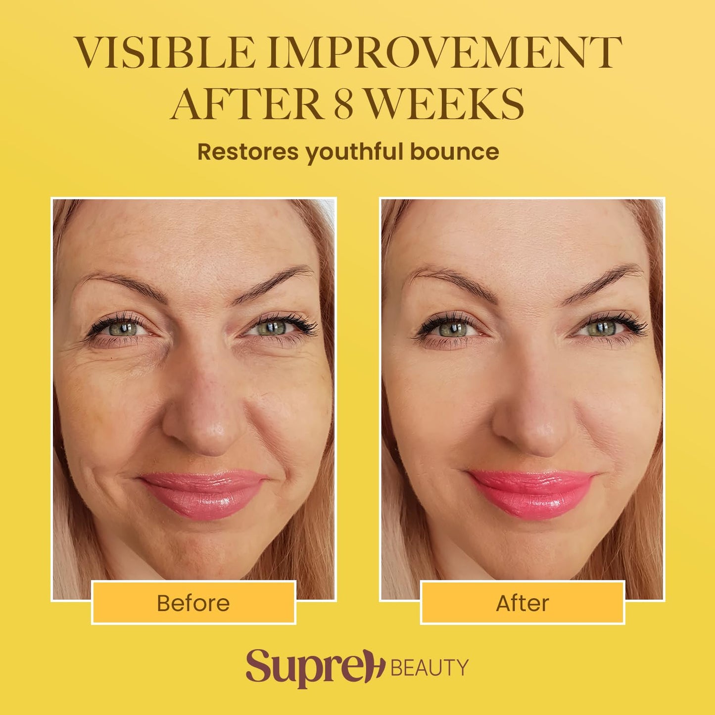 Bee Venom Cream Wrinkle Filler - Instant Face Lift & Eye Tightener with Hyaluronic Acid | 50 ML