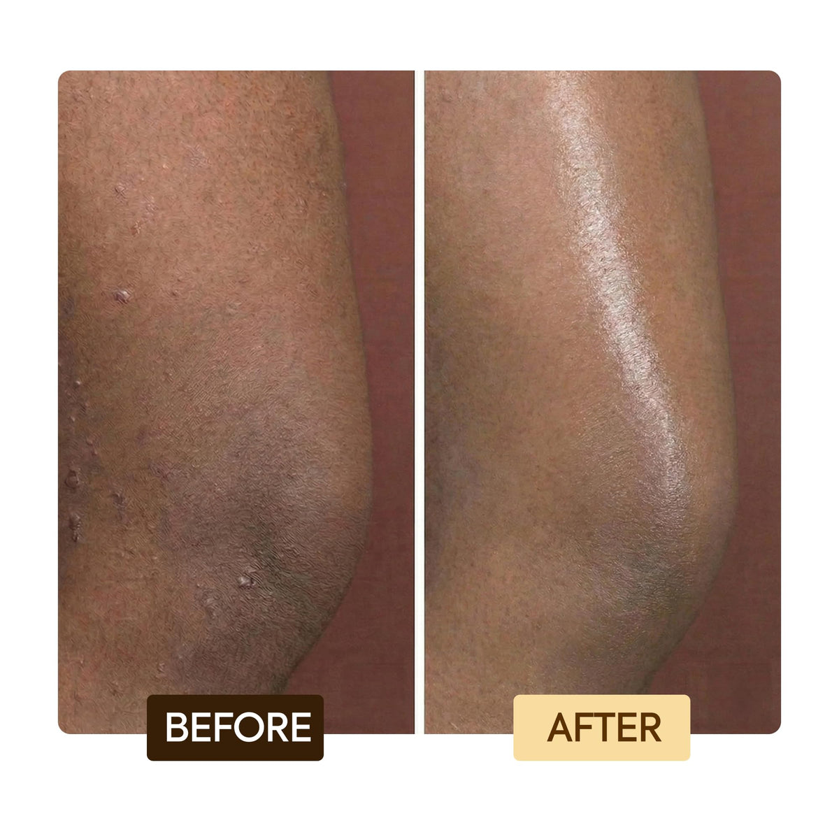 Makari Exclusive Active Intense Tone Boosting Body Glycerin (16.8 oz) | Skin-Brightening Body Glycerin | Moisturizes and Softens | Supports the Look of Even Skin Tone | For Most Skin Types