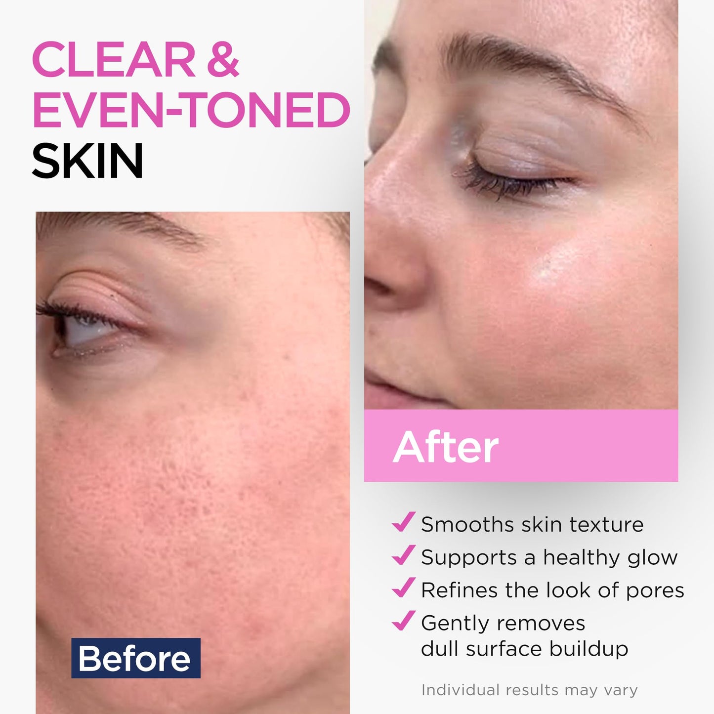 Ember Cloud Glycolic Acid Serum for Face 15% - Extra Large Size (8 Oz) - Advanced Formula to Support Skin Radiance, Addressing Uneven Tone & Fine Lines