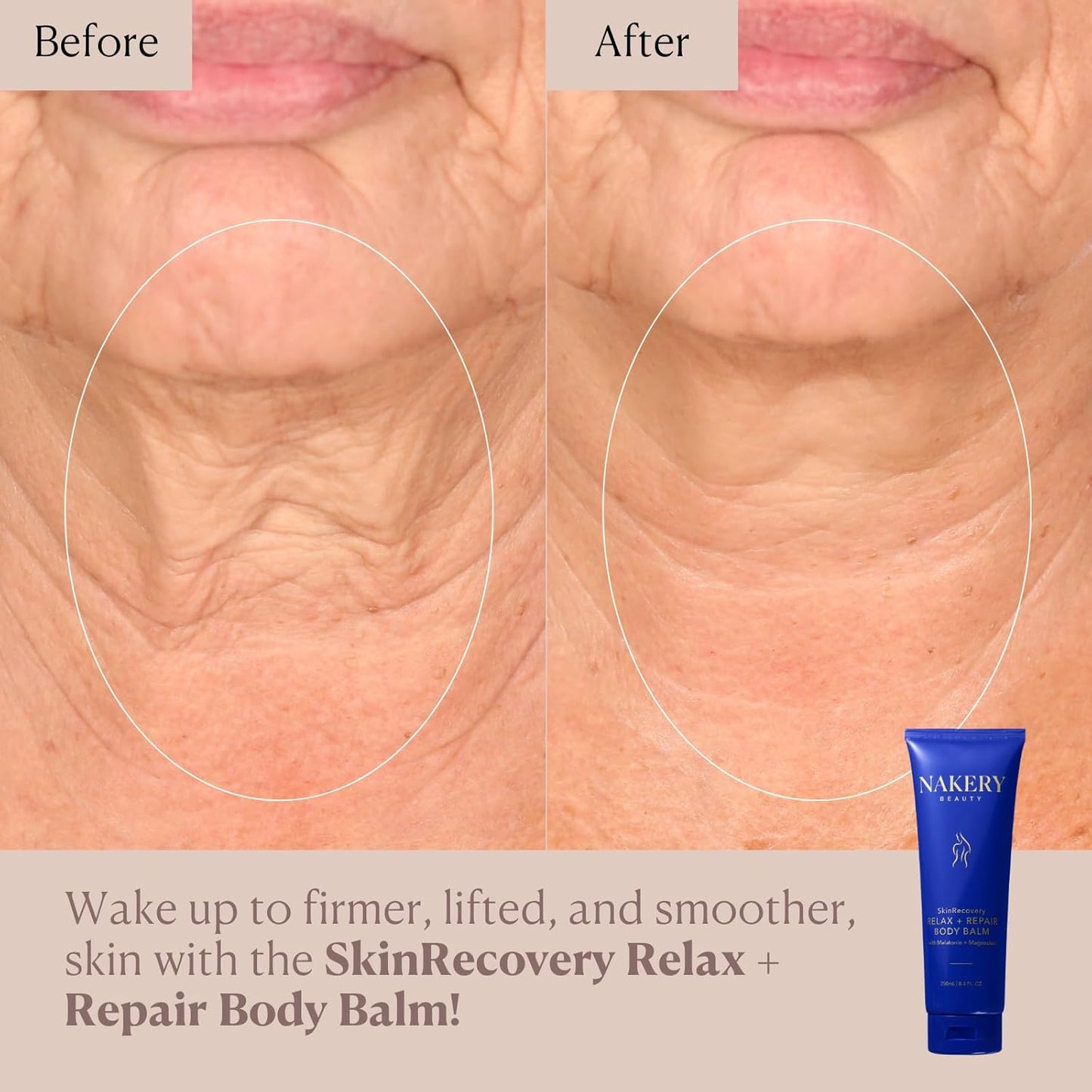 **SkinRecovery Body Balm - Magnesium Melatonin Sleep Lotion with Retinol & SepiLift | Firming Cream for Crepey Skin, 250mL**
