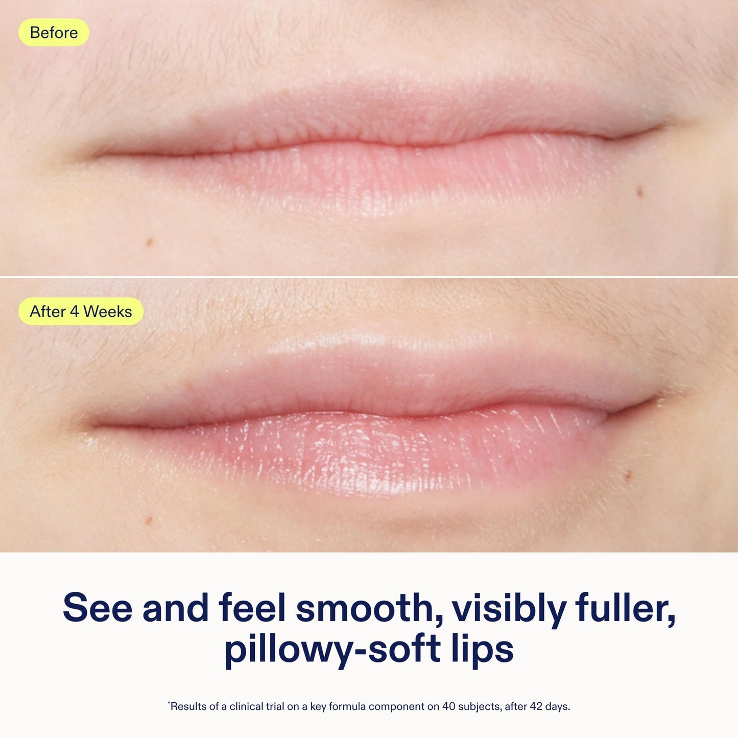Skinfix Triple Lipid Lip Treatment - 0.27 oz - Hydrating, Volumizing Balm - Visibly Smooths Fine Lines - Fragrance Free - Vegan, Cruelty Free