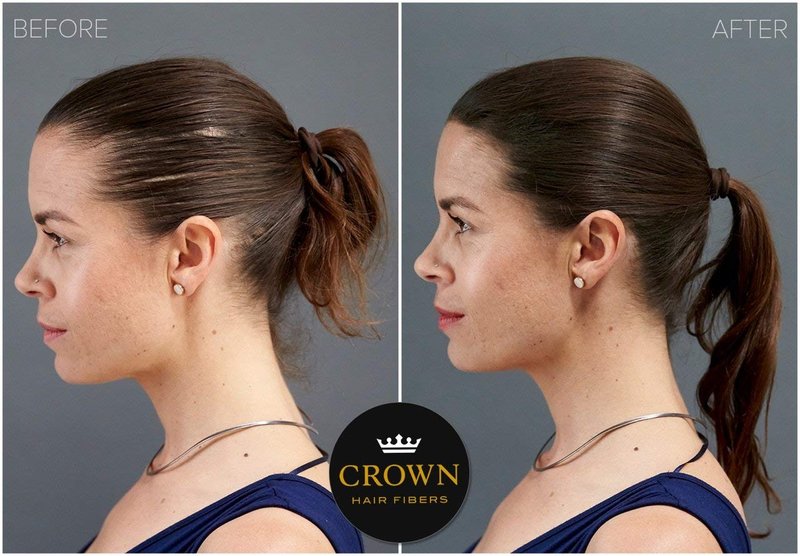 CROWN Hair Building Fibers (28g) - Instantly Cover Fine & Thinning Hair for a Thicker, Fuller Look - A Natural Keratin Concealer - 13 Shades for Men & Women - Dark Brown