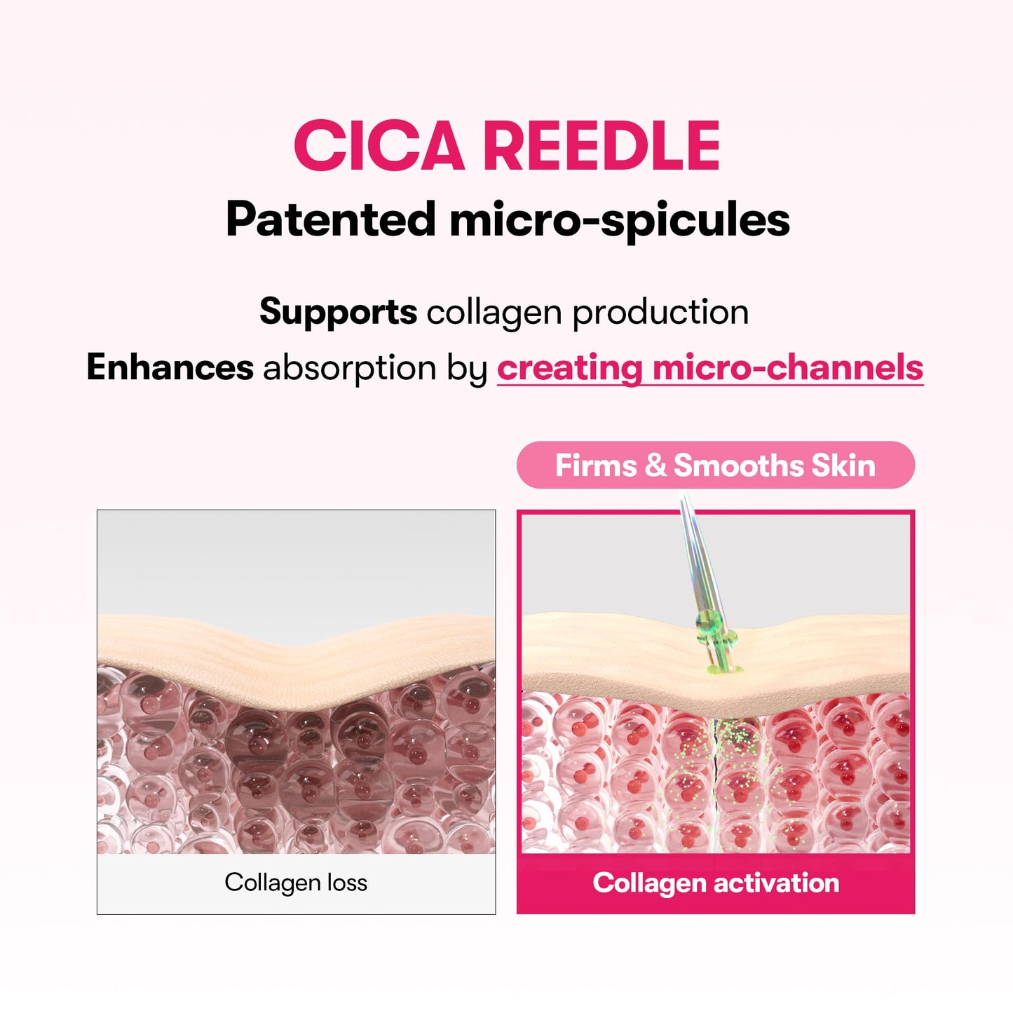 VT COSMETICS Collagen Reedle Shot 100 Serum, Pink Skin Booster for Plumping, Firming & Glowing Skin, 500Da Low Molecular Extract, Spicule Microneedle Treatment, K-Beauty Face Serum, 1.69 fl oz (50ml)