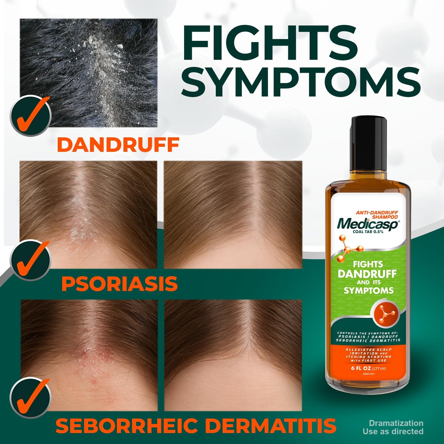 Medicasp Coal Tar Anti-Dandruff Shampoo, Flakes Shampoo, 6 fl oz