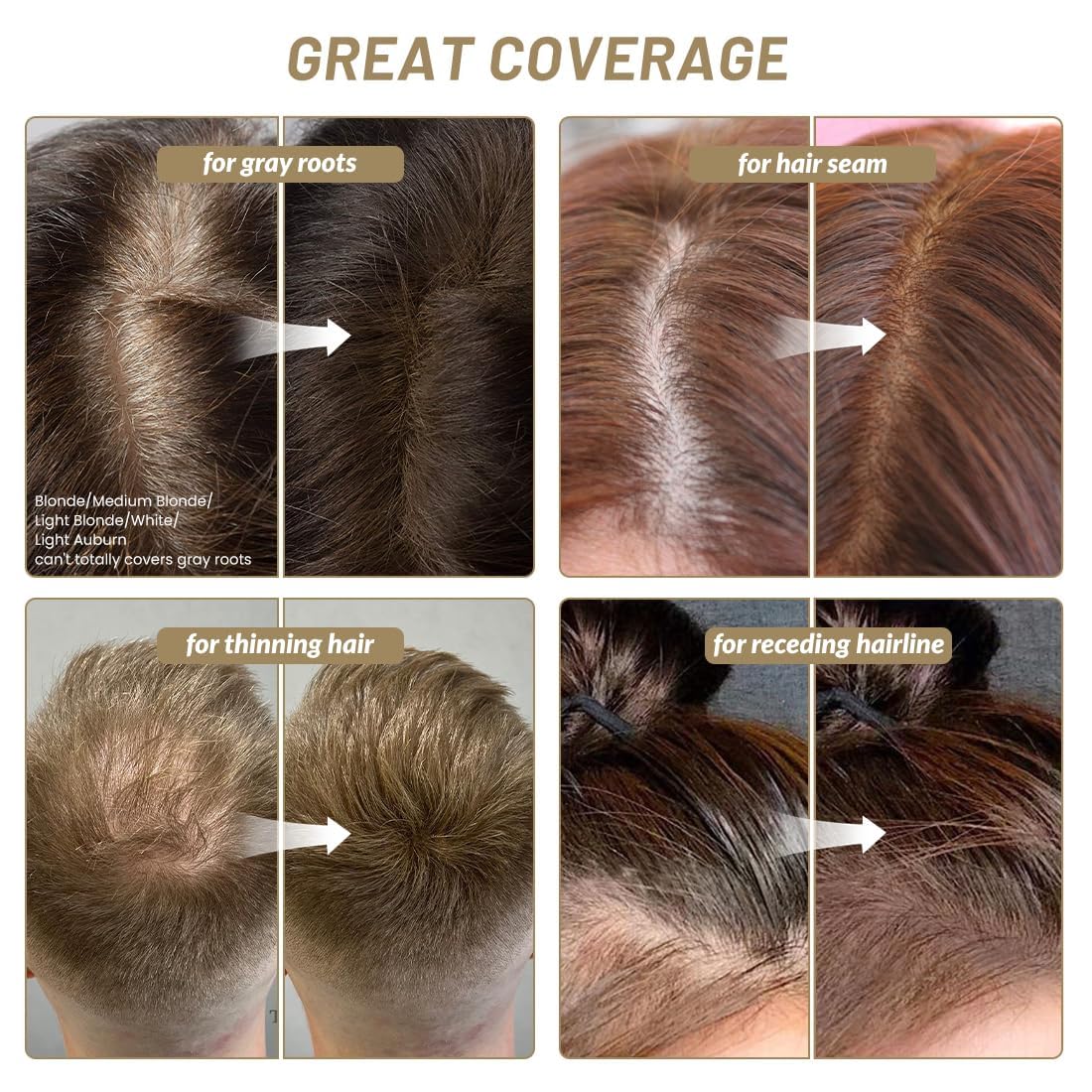 SOVONCARE Instantly Hairline Powder-Maycheer Conceals Gray Hair Loss Shadow Coverage Magic Color Root Touch Up for Women & Men