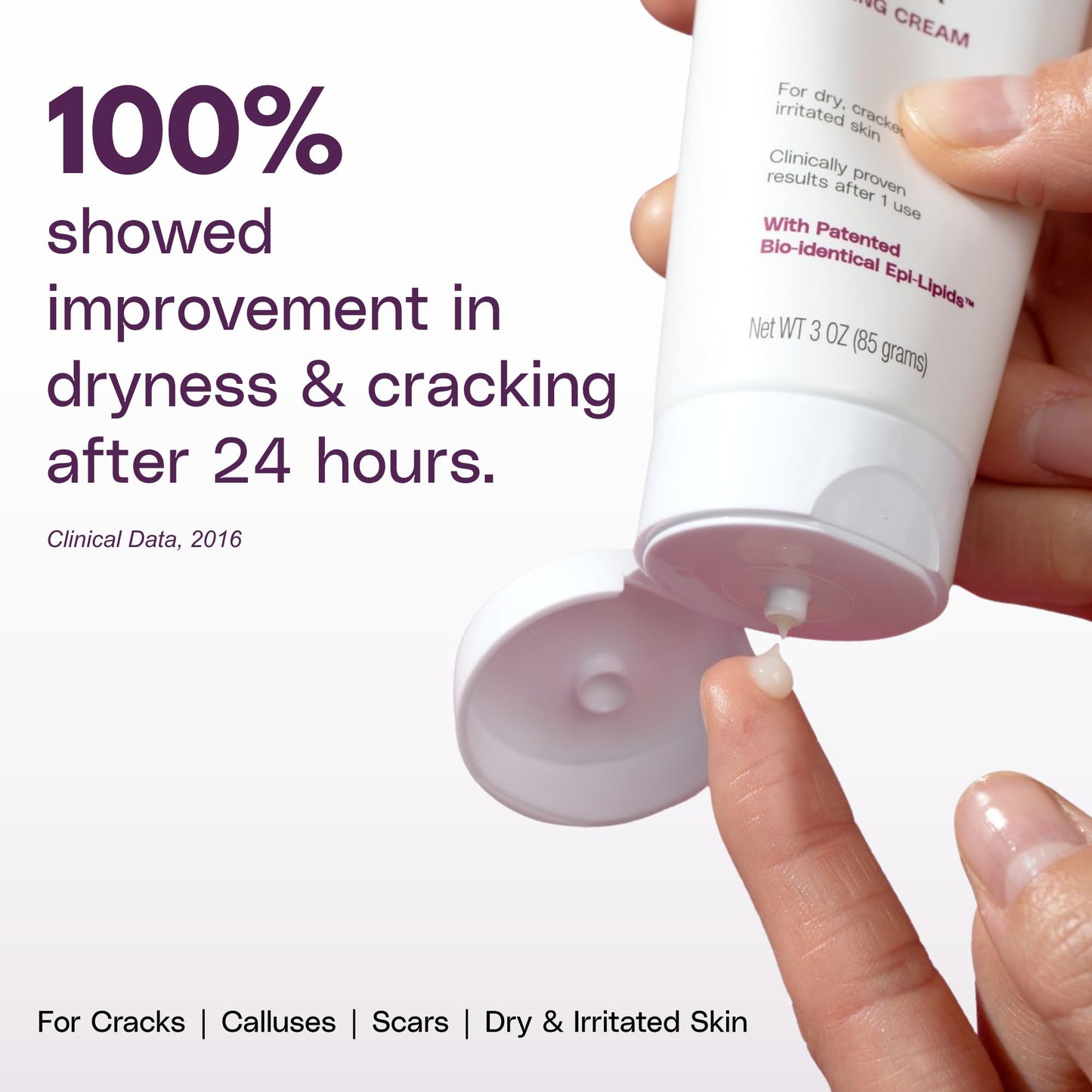 SkinIntegra Rapid Crack Repair Cream, 25% Urea with Lactic Acid, Restores Cracked Heels and Diabetic Feet, Post-Surgery Scar Care, Fragrance-Free Barrier Cream, 3 oz