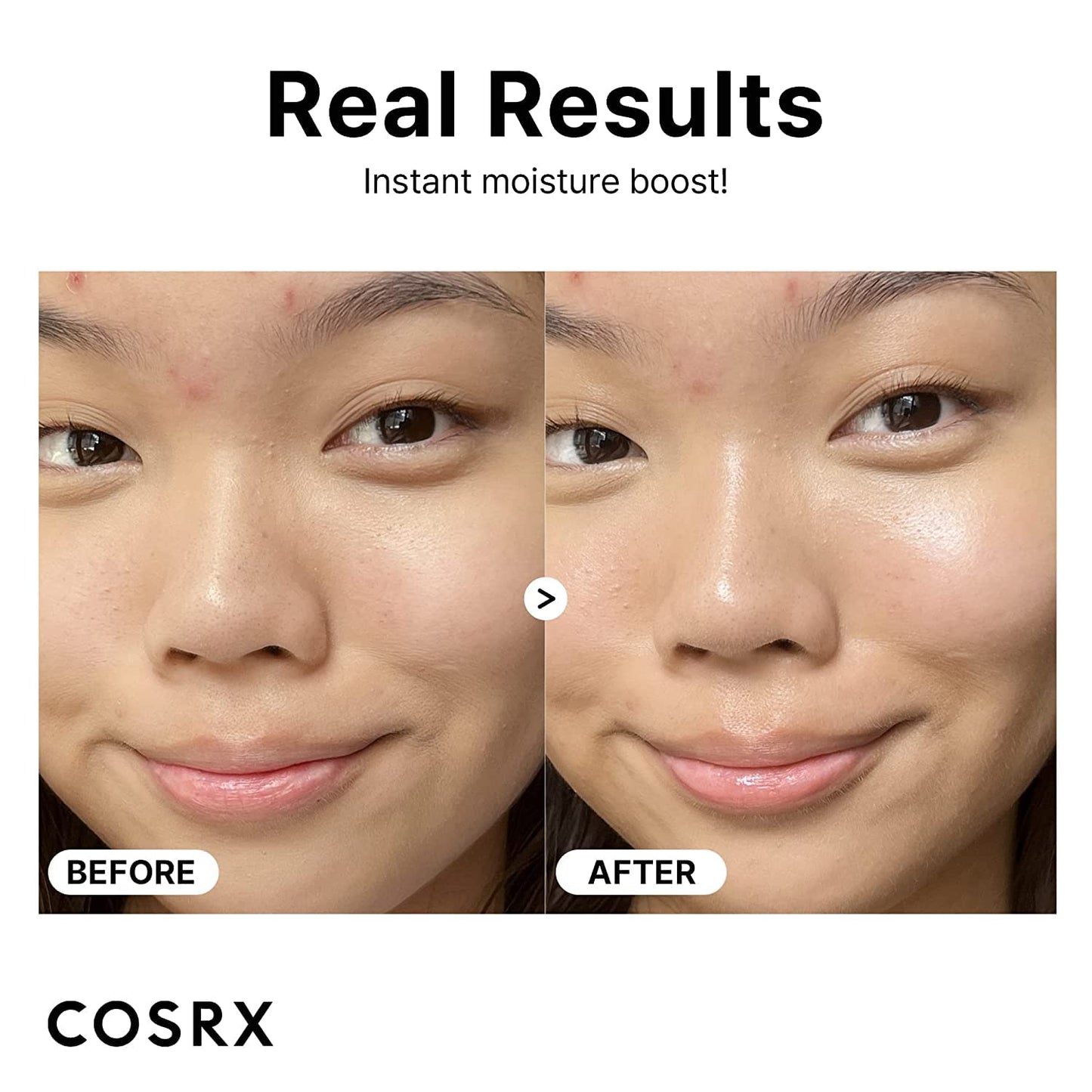 COSRX Hyaluronic Acid 3% Serum, Ceramide, Unisex Skin Serum, Dry Skin