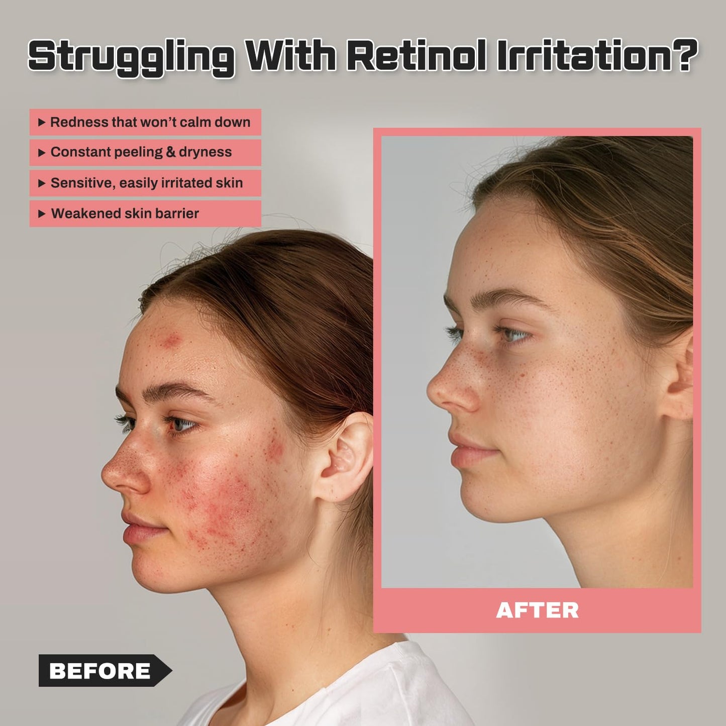 benetus Bakuchiol Retinol Alternative Anti-Aging Moisturizer for Mature & Sensitive Skin with Peptides & Ceramides, Anti-Wrinkle & Barrier Repair, Hydrating Daily Facial Moisturizer, 1.69 fl oz