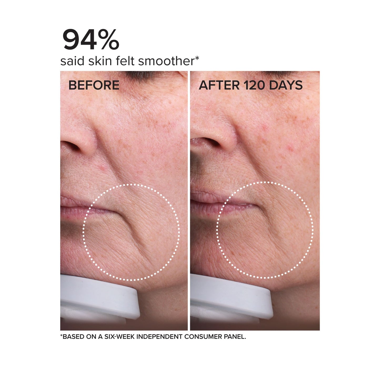 DRMTLGY Needle-less Serum - Anti-Aging Serum for Fine Lines & Wrinkles - Niacinamide Serum with Potent Blend of Hyaluronic Acid, Peptides & Ceramides
