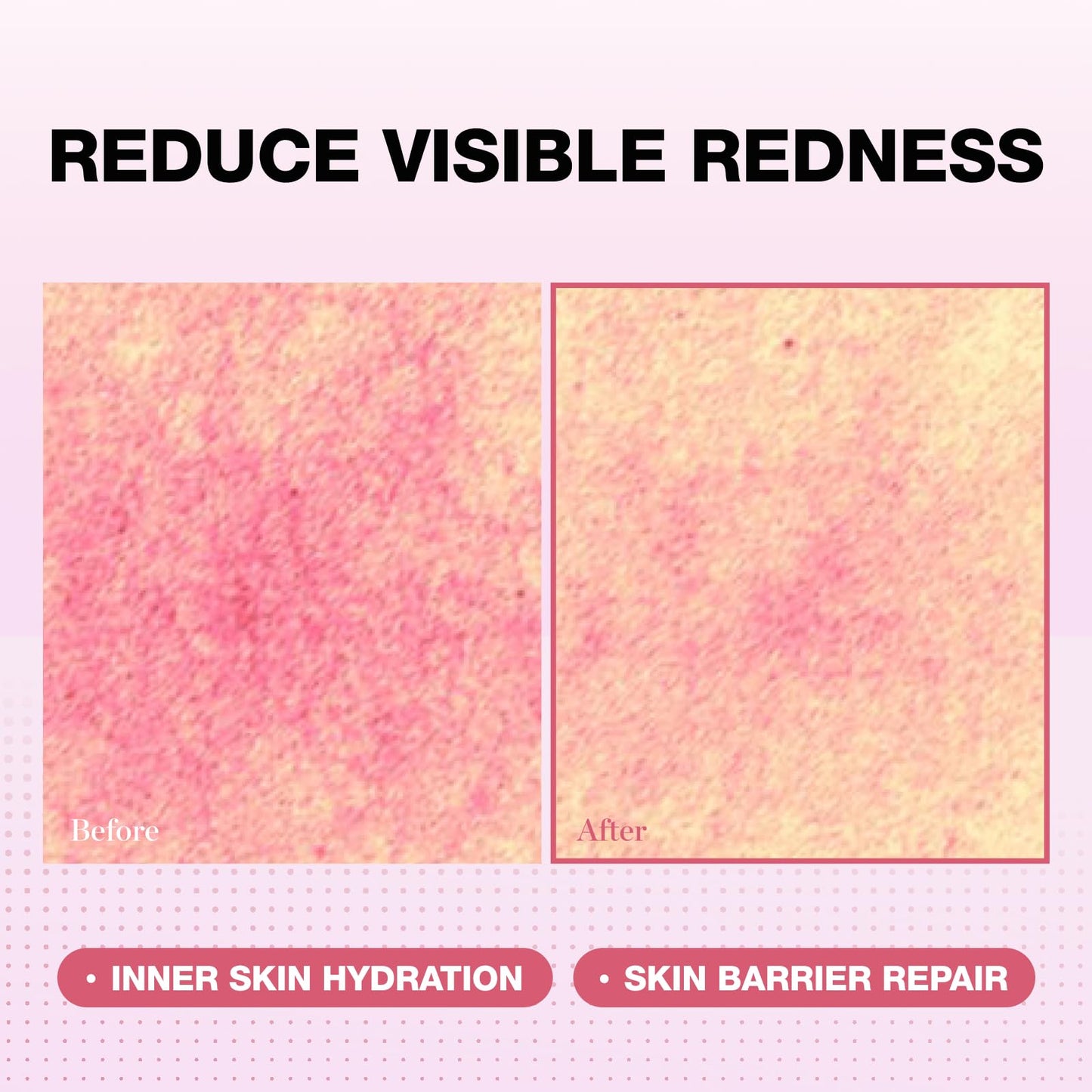 Physiogel Red Soothing Essence, Reduces Redness, Hydration for Dry & Sensitive Skin, Fragrance-Free, Non-Comedogenic, Dermatologist-Tested, Lightweight