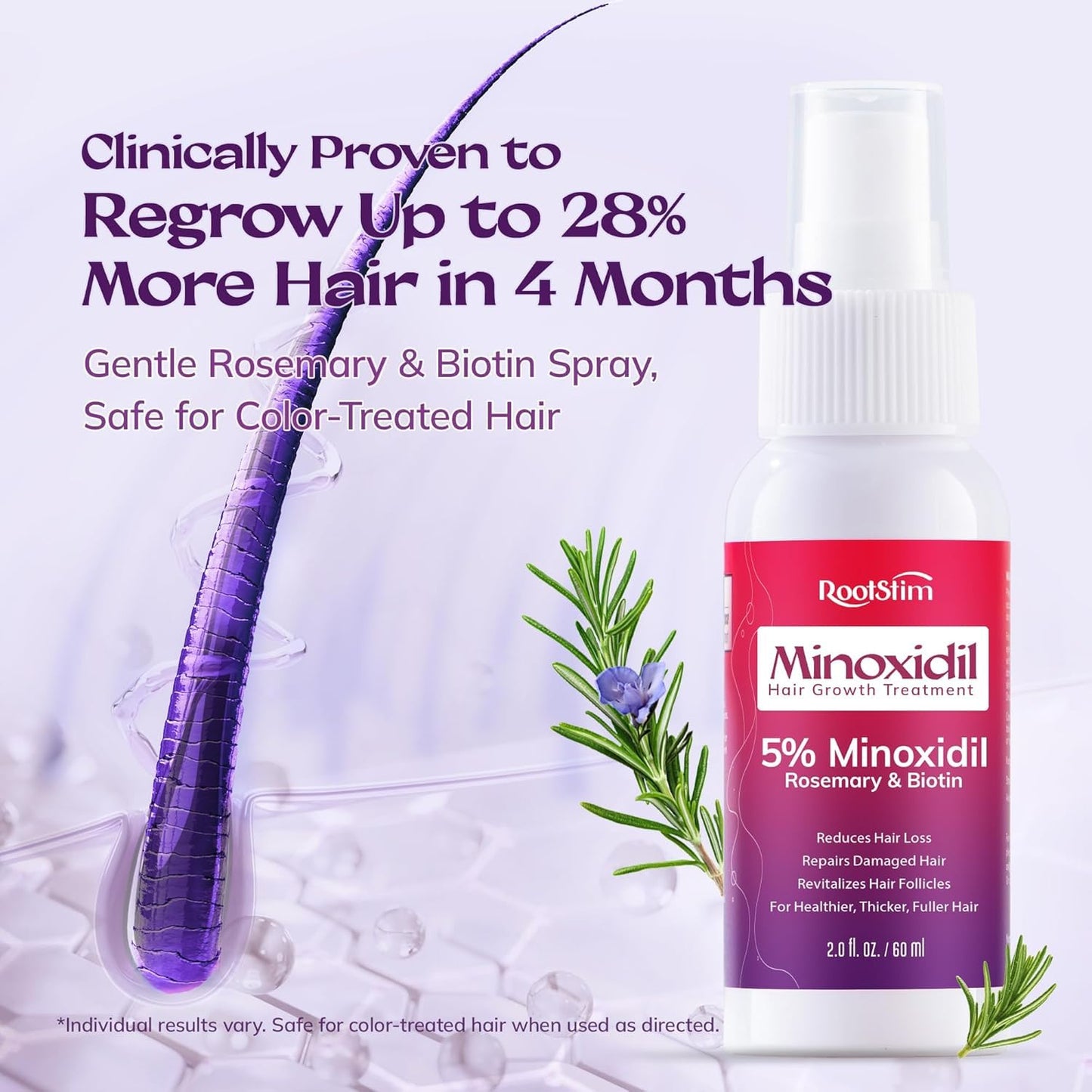 Women's 5% Minoxidil Spray for Hair Growth: RootStim Extra Strength Minoxidil with Rosemary & Biotin for Thinning Hair Regrowth and Fuller Hair - 2.37 Fl Oz