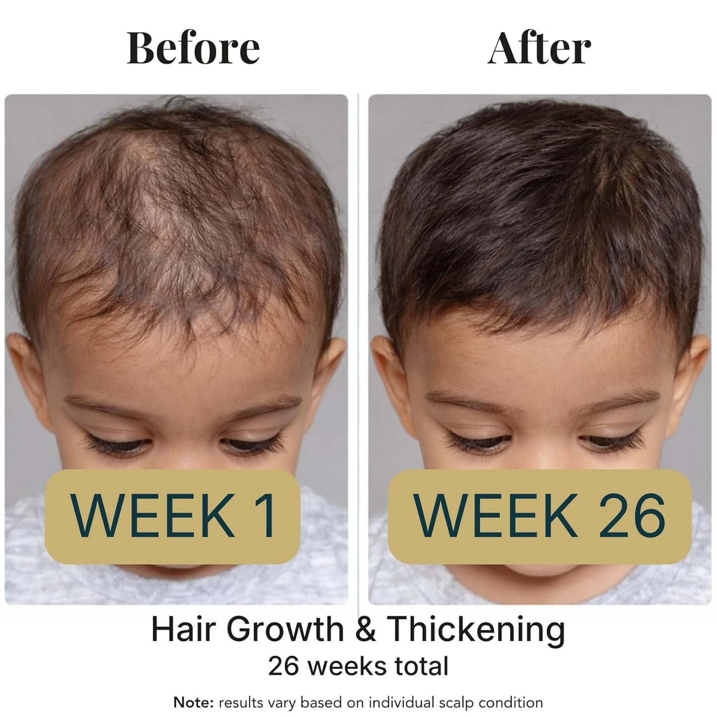 Kids & Baby Hair Growth Oil - High Potency Scalp Treatment with 26 Cold-Pressed Botanicals | For All Hair Types