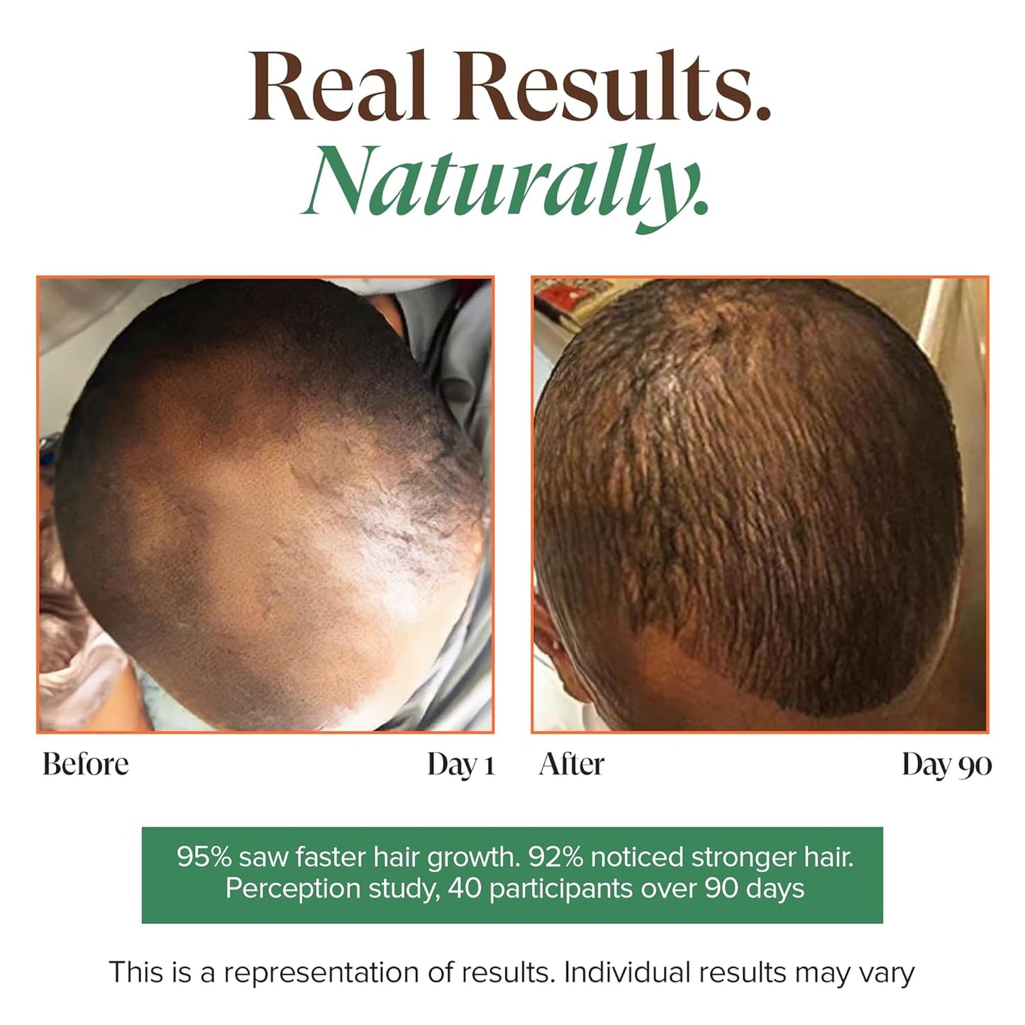 Haitian Black Castor Oil - Cold Pressed for Skin & Hair | Hexane Free, Natural Humectant | 3.4 Fl Oz - Rosemary Peppermint