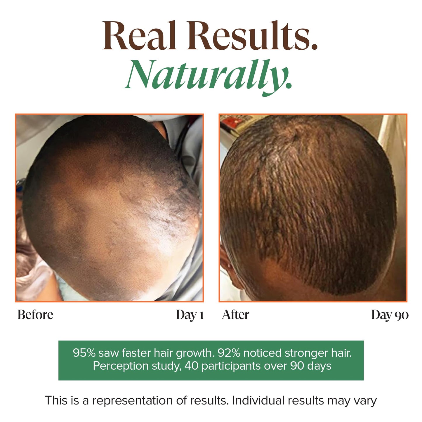 Kreyol Essence - Haitian Black Castor Oil for Skin and Hair, Glass Bottle - Fuller-Looking Hair, Pure, Hexane Free, Cold Pressed, Natural Humectant (Original, 3.4 fl oz)