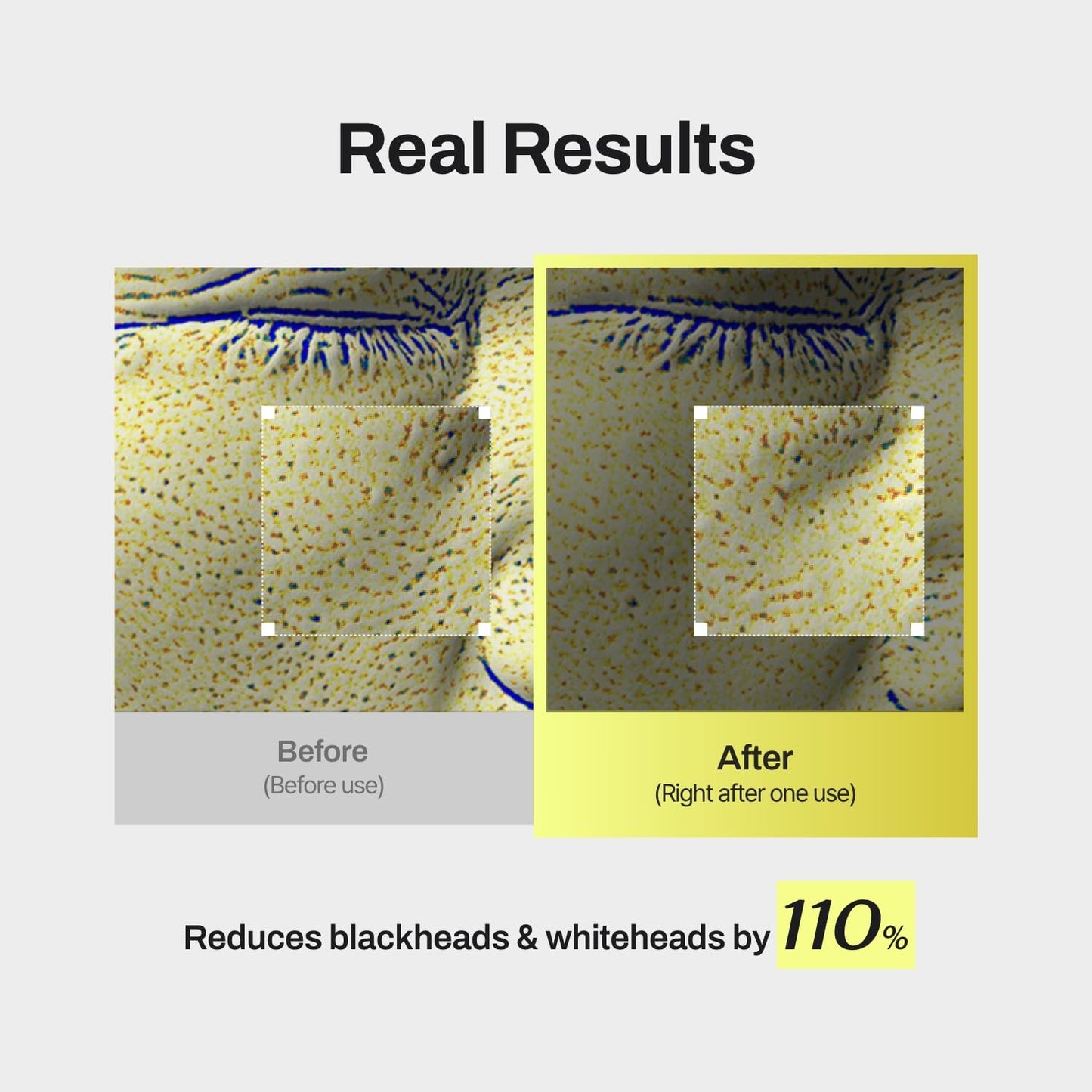 MEDITHERAPY Niacin X BHA Pore Mild Clear Toner Pad - Korean Toner Pads for Face - Hydrating Face Toner Pore Minimizer - Exfoliating Pore Care with Dual-Sided Pads - Gentle Blackhead Remover, 60 Pads