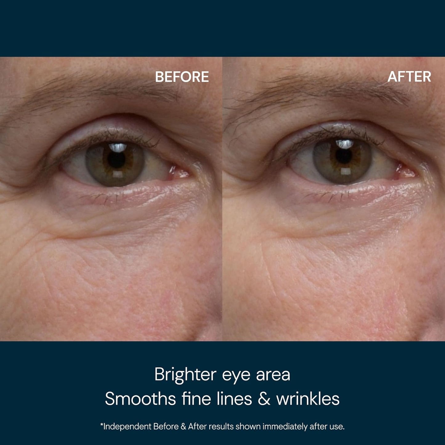 ELEMIS Pro-Collagen Eye Revive Mask - Anti-Wrinkle Treatment for Brightening, Hydrating & Rejuvenating Skin