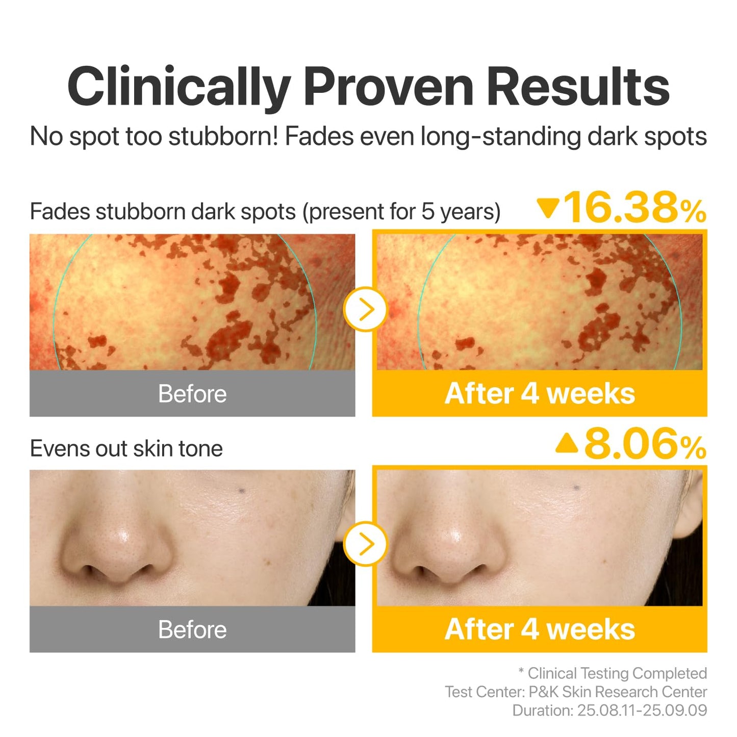 numbuzin No.5 Serum | Glutathione Vitamin Concentrated Serum 30ml Travel Set (+1ml*10ea) | Glutathione, Vitamin C, Tranexamic Acid | Hyperpigmentation, Acne Scars, Korean Skincare | 1.31 fl. oz.