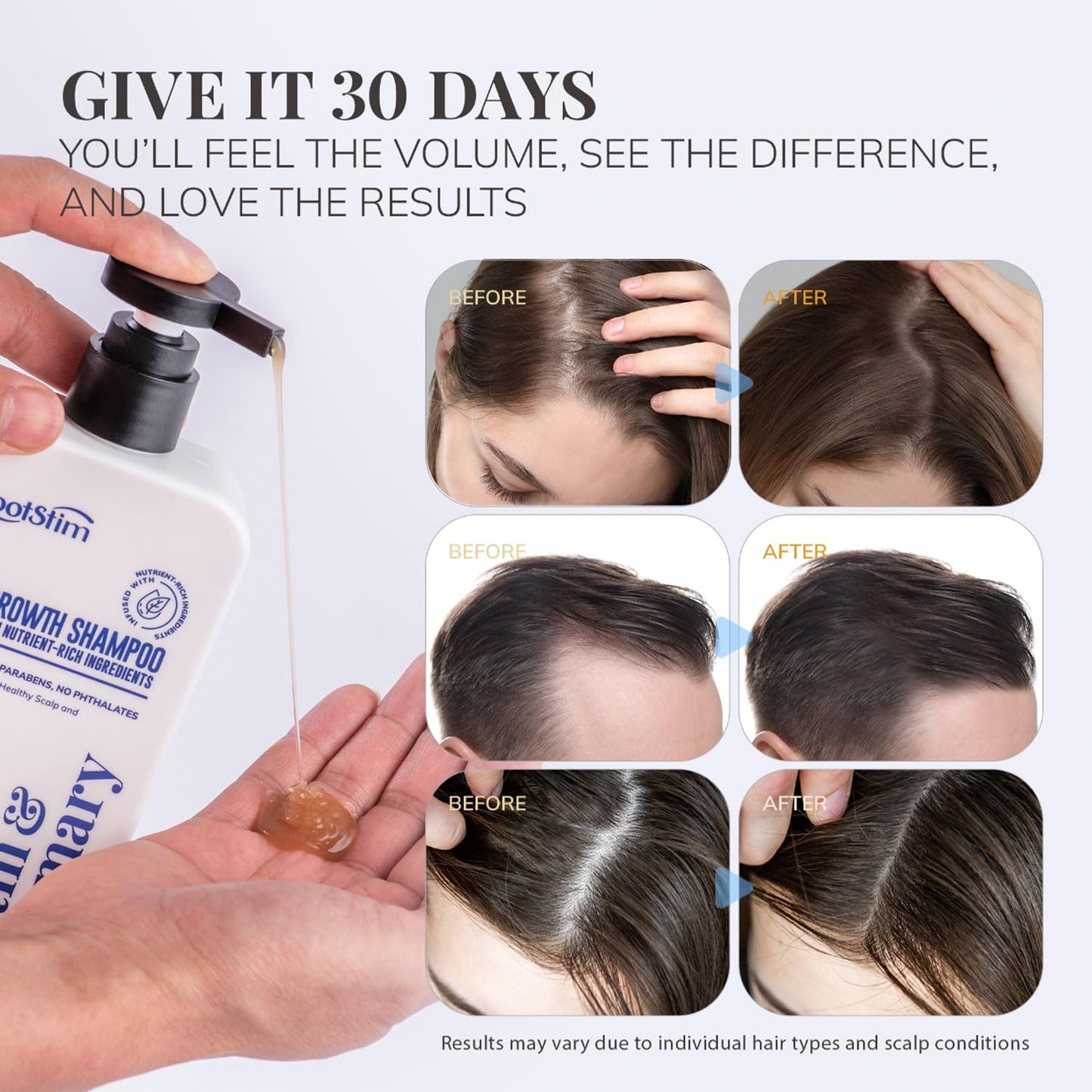 Biotin & Rosemary Shampoo for Hair Growth - Natural Thinning Hair Treatment | Sulfate-Free 10 fl oz