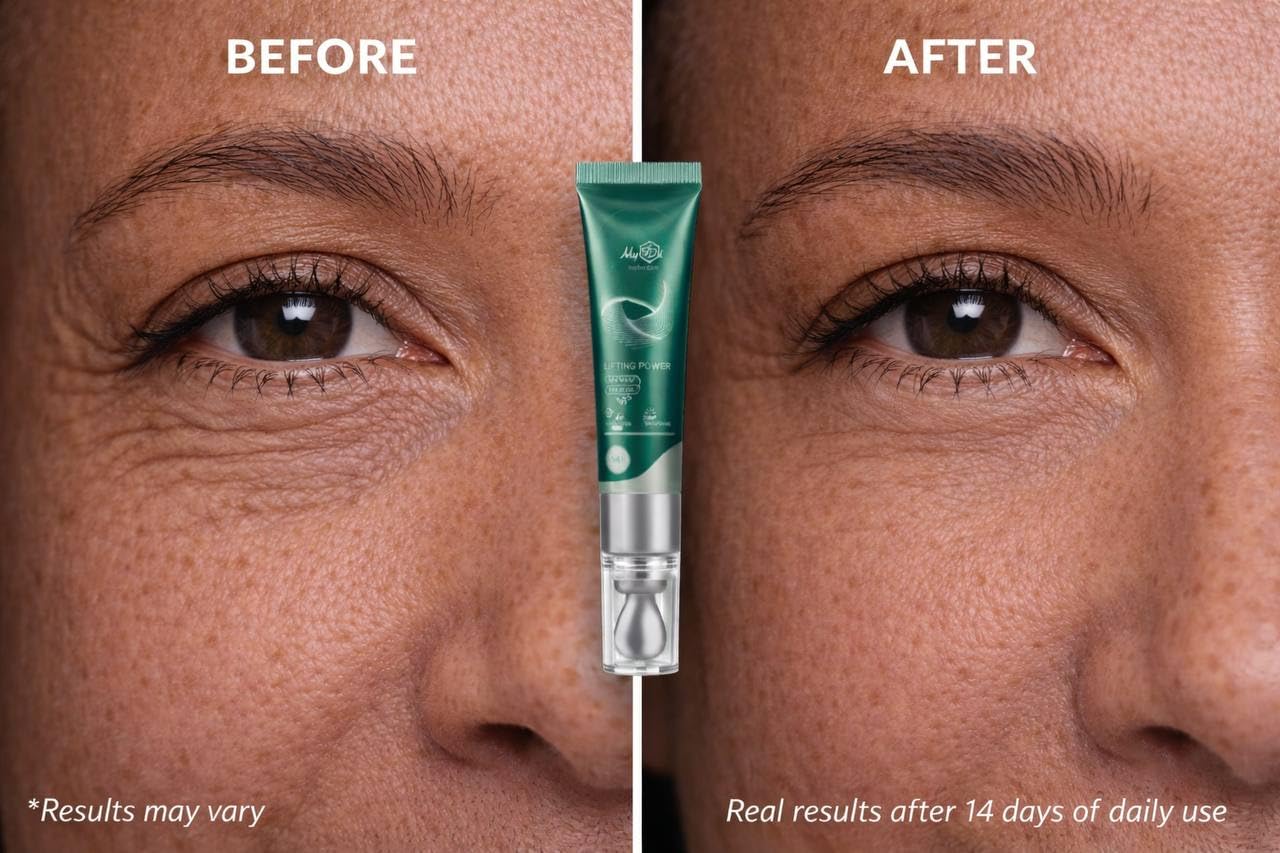 MyIDi Lifting Power Eye Fluid – Eyelid Lifting Treatment for Hooded Eyes & Fine Lines – Multi-Peptide Eye Serum with Ceramide NG, Hyaluronic Acid & Palmitoyl Tripeptide-1 – 0.5 fl oz / 15 ml
