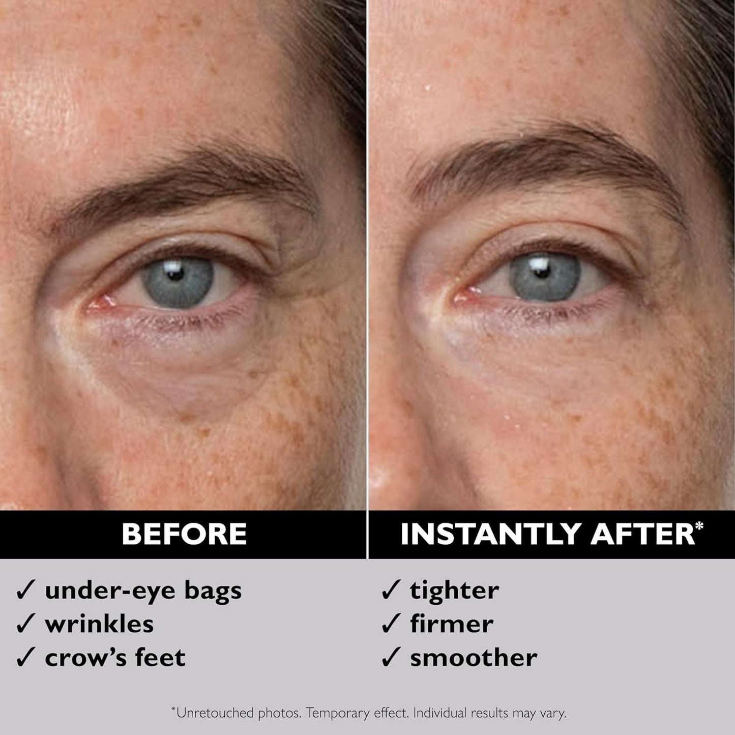 Peter Thomas Roth Instant FIRMx Eye Tightener - Easy-Wear Formula for Firming & Smoothing | Pack of 2