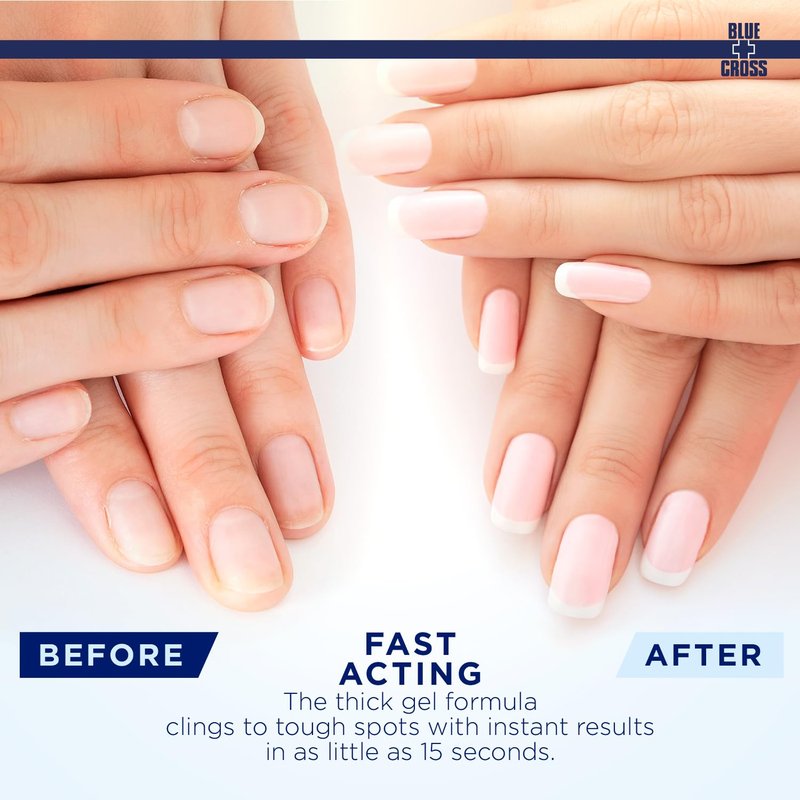 Blue Cross Cuticle Remover Liquid Gel, Cuticle Softener for Nails, Hydrating, Moisturizing, Professional Nail Care for Brittle Hang Nails, Dry Cuticles, Made in USA, 8oz, Citrus