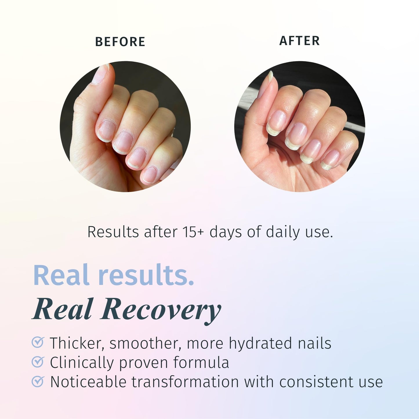 duri Rejuvacote 1 Nail Growth System - Original Maximum Strength Formula - Nail Strengthener and Nail Growth - Base and Top Coat - Pack of 2-0.45 fl. oz.