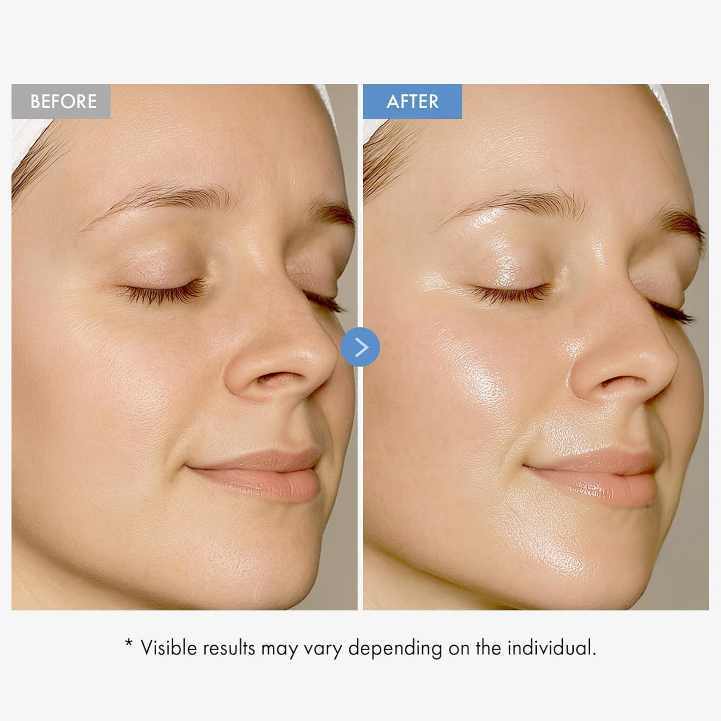 Hyaluronic Acid Face Cream - Long-Lasting Hydration with Vitamin B5 & Collagen | 50ml (1.69 fl. oz.)
