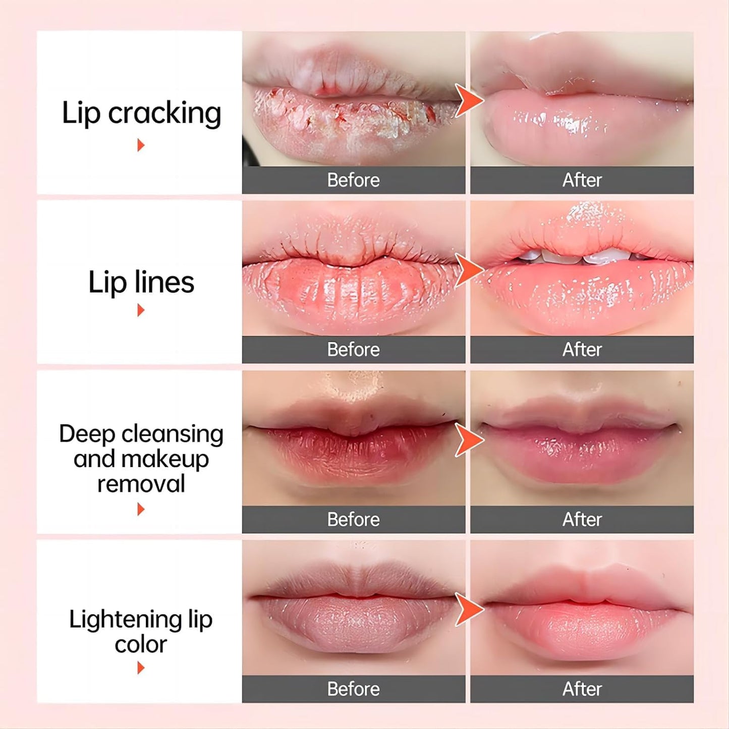 Natural Lip Lightening Balm with Hyaluronic Acid | Exfoliates Dead Skin, Fades Discoloration, Moisturizing for Smokers, Men & Women