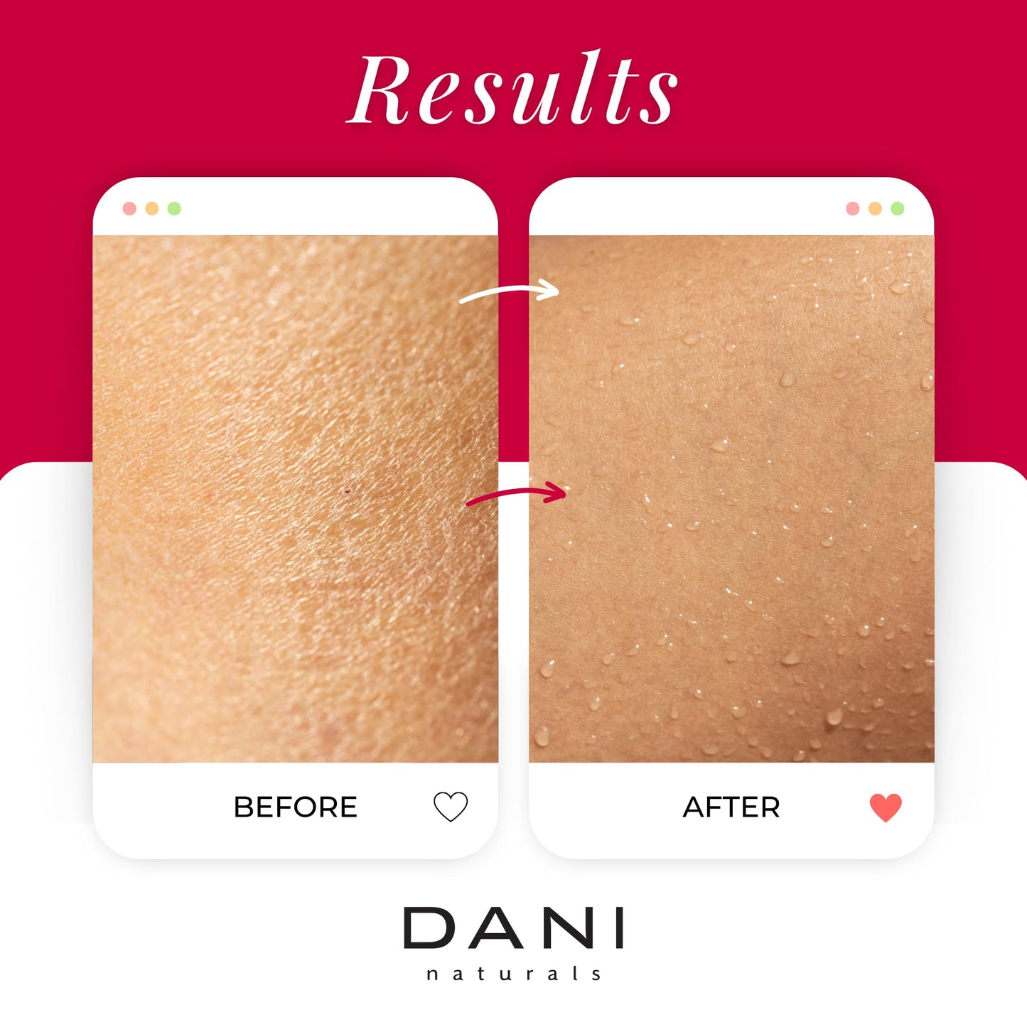DANI Naturals Citrus Rose Gentle Exfoliating Sugar Scrub, Vegan, 14oz