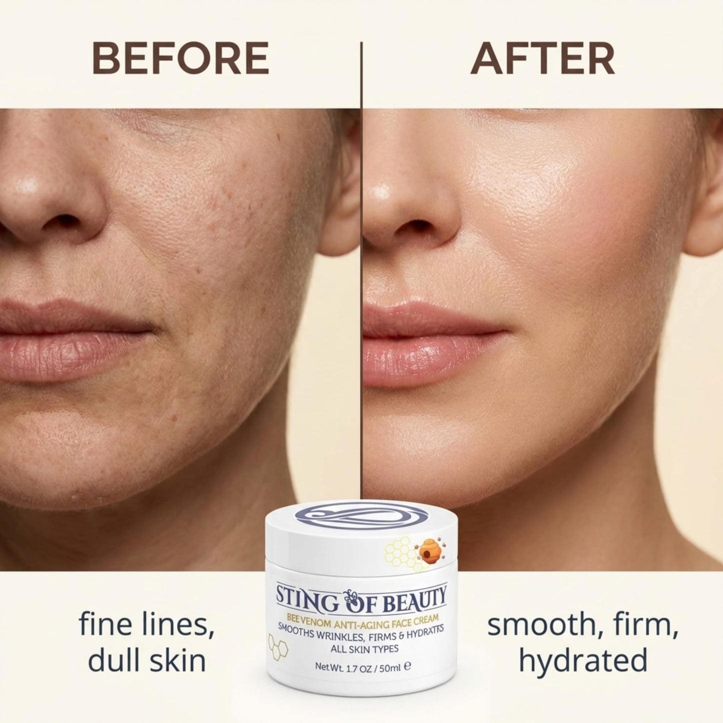 STING OF BEAUTY Anti-Aging Face Cream – Bee Venom & Propolis for Wrinkles & Firming, Visible Lifting Effect, Made with Propolis from Our Own Beehives, 1.7 oz