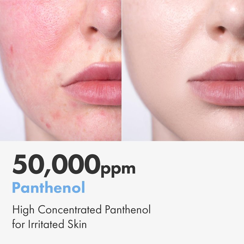NATUREKIND Cica Panthenol Cream, 50,000ppm Panthenol, Centella Asiatica & Hyaluronic Acid, Barrier Repair Moisturizer for Dry, Sensitive Skin, Korean Skincare, 150g, 5.29 oz.