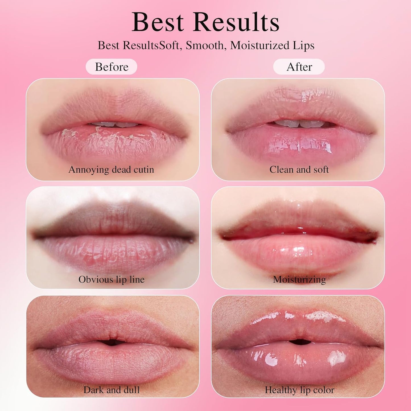 PHA 5% Lip Exfoliator - Gentle Salicylic Acid Formula for Hydration | 0.5 fl oz (15 mL)