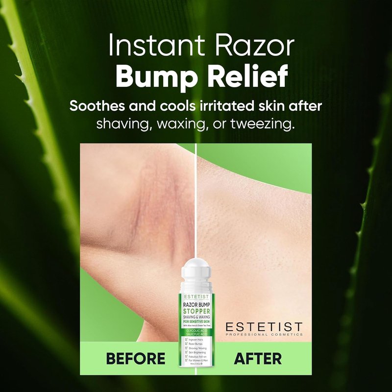 Estetist Razor Bump Stopper - Sensitive Skin After Shave Serum | Calms Irritation & Soothes Skin