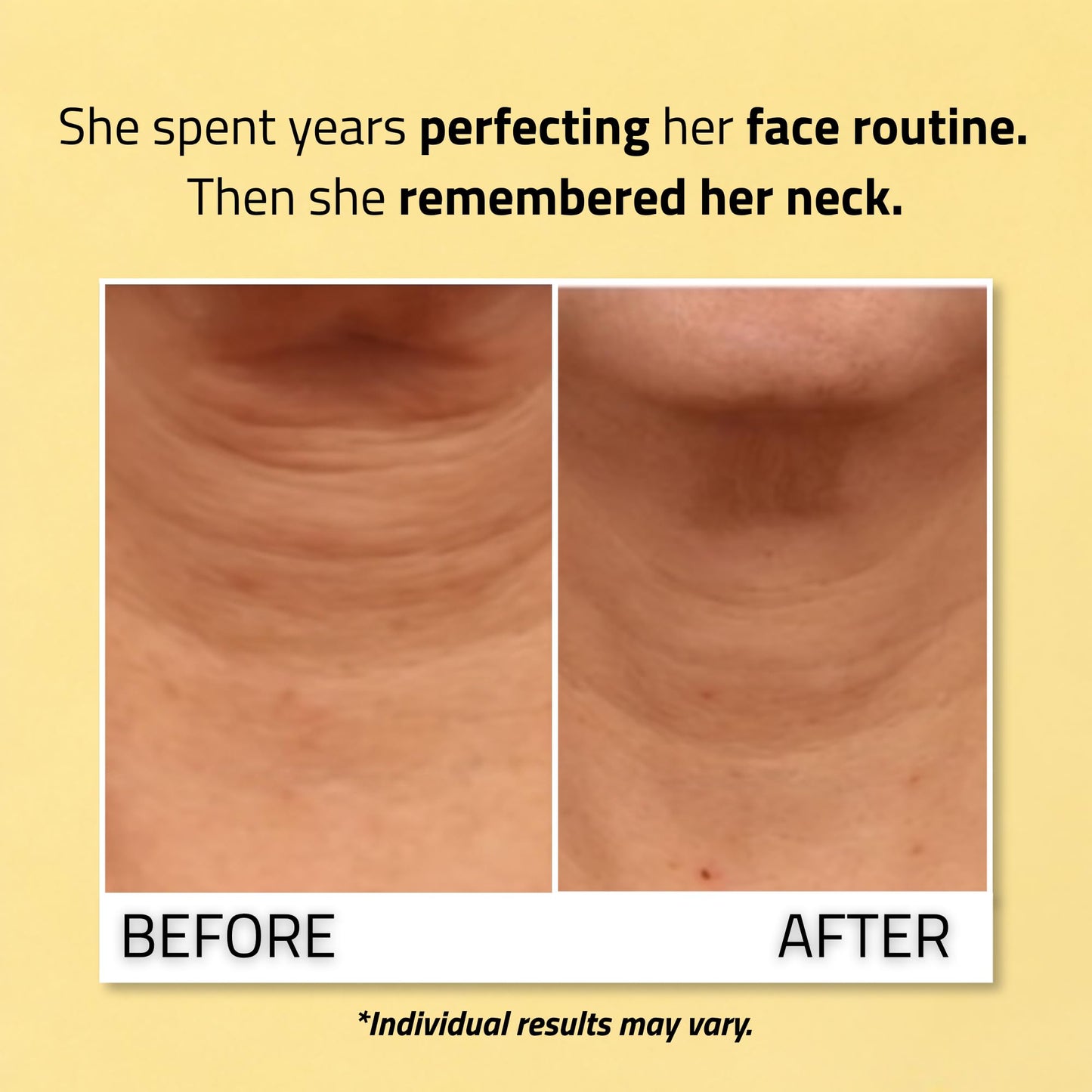 YEOUTH Neck Firming Cream with Vitamin C and Peptides, Neck Cream for Tightening and Firming Chest, Décolleté, Double Chin, Turkey and Crepey Skin