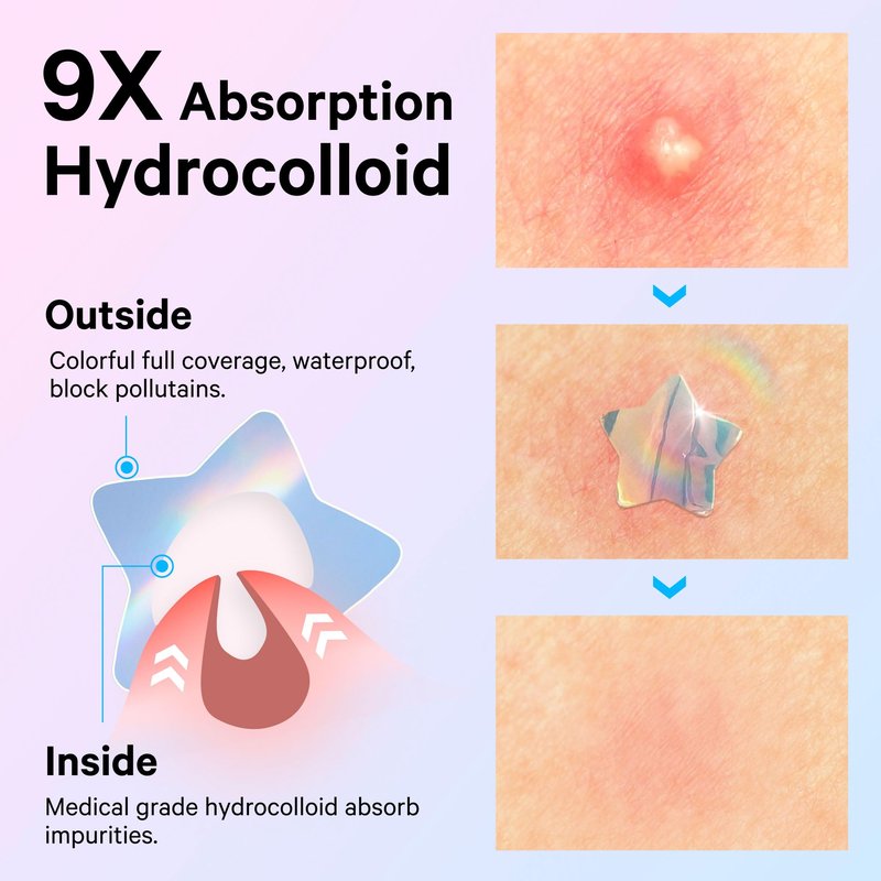 Sosky Hologram Pimple Patches for Face, Hydrocolloid Acne Patches with Salicylic Acid, Cute Star Zit Stickers,Colorful Blemish Covers,144 Count Blue Pink Star Heart Moon Cloud Butterfly Flower