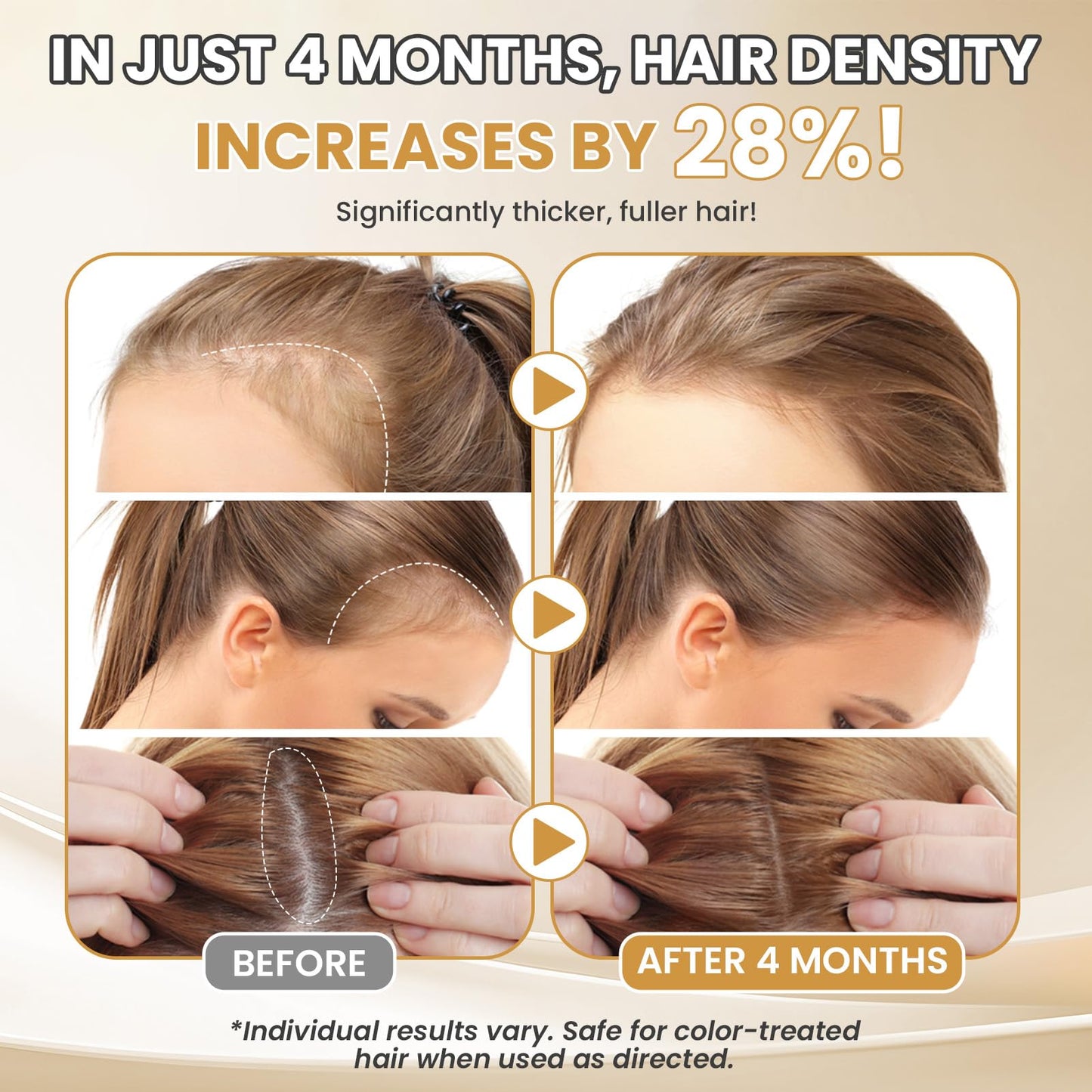 5% Minoxidil for Women Hair Growth Serum Topical Minoxidil Hair Regrowth Thicker Prevent Hair Loss for Thickening Longer Fuller Healthier Hair 2.05oz