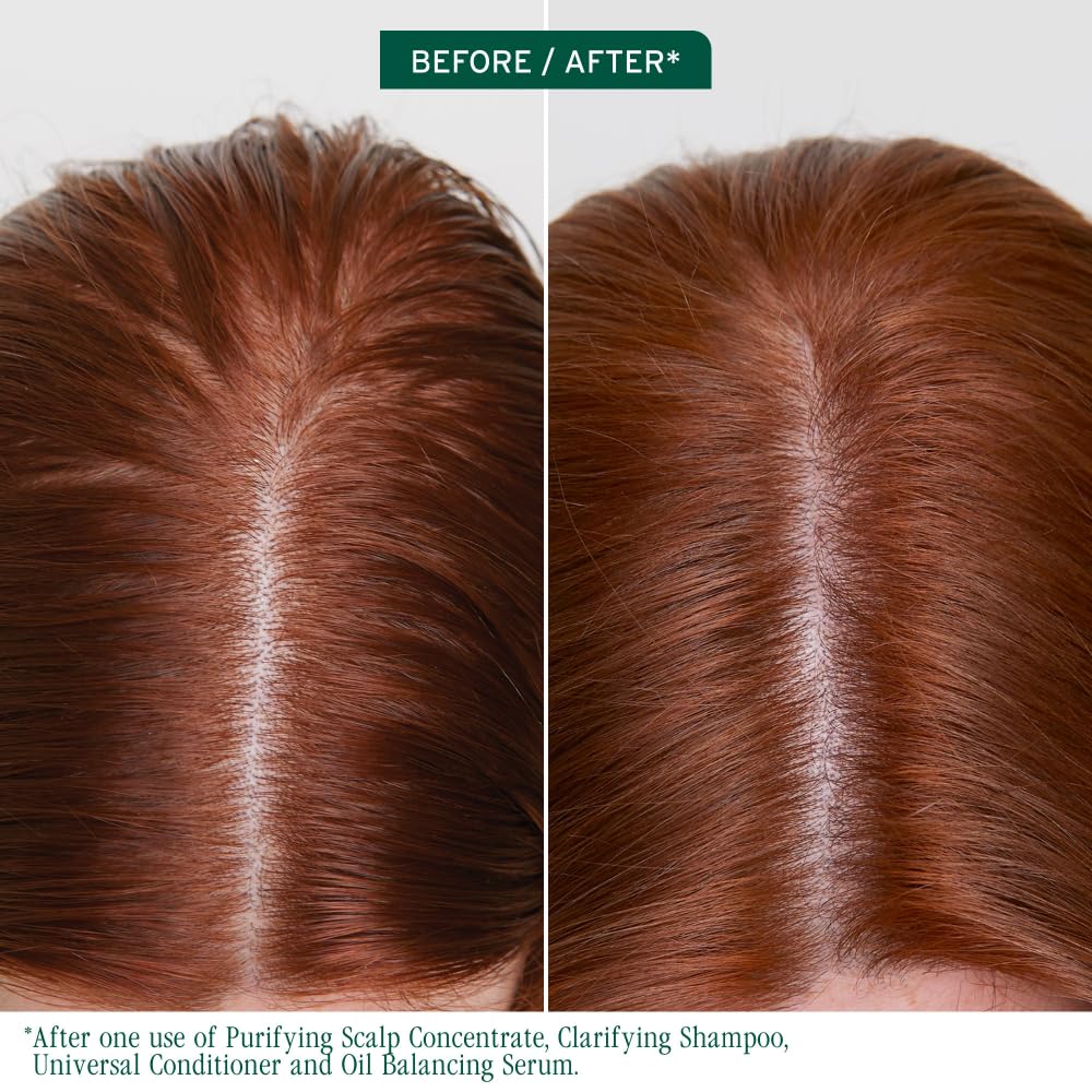 Biolage Scalp Sync Oil Balancing Hair Serum - Leave-In Scalp Treatment with Fermented Tea Blend | 1.6 Fl Oz